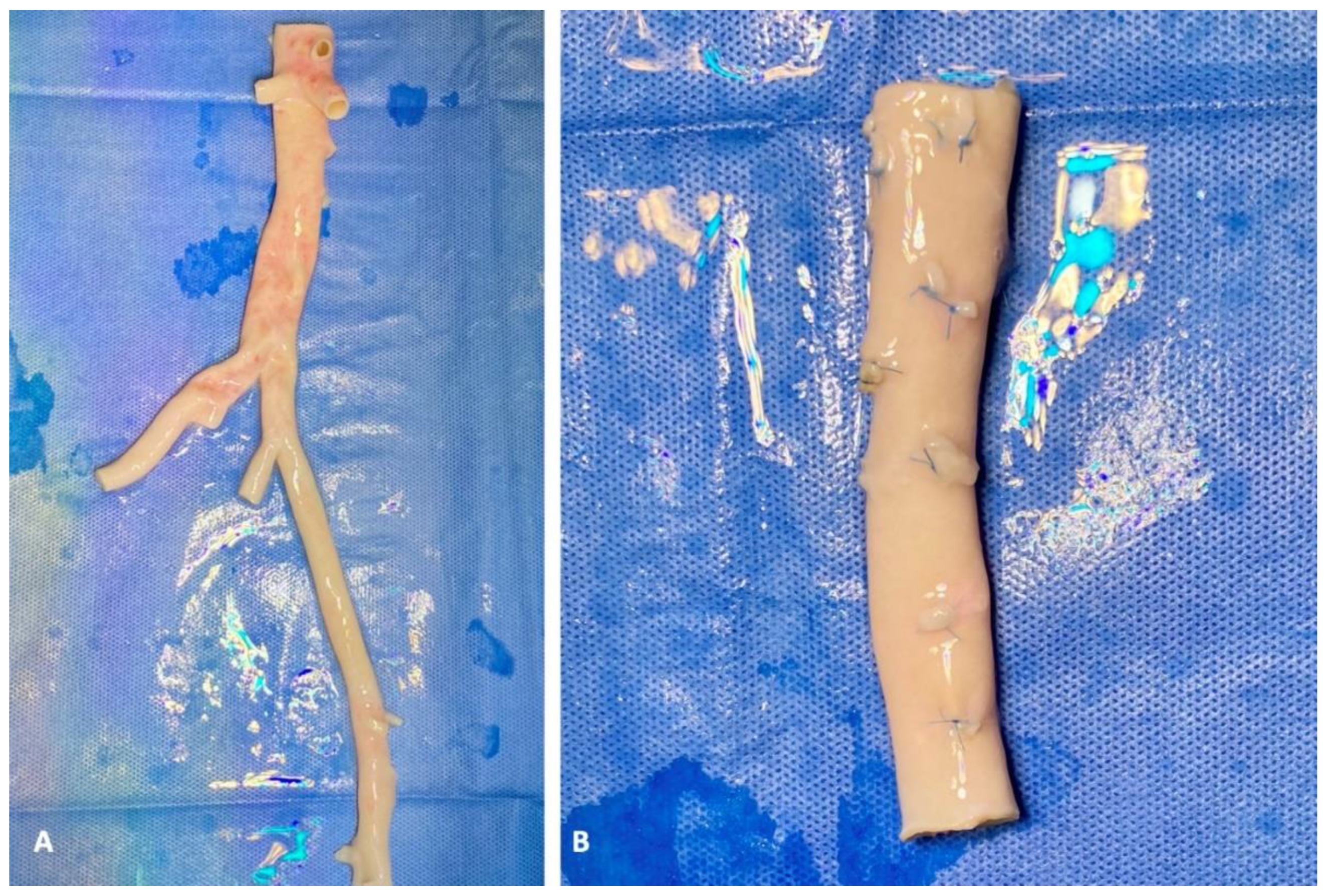 Uro 02 00002 g003 Uro 02 00002 g003