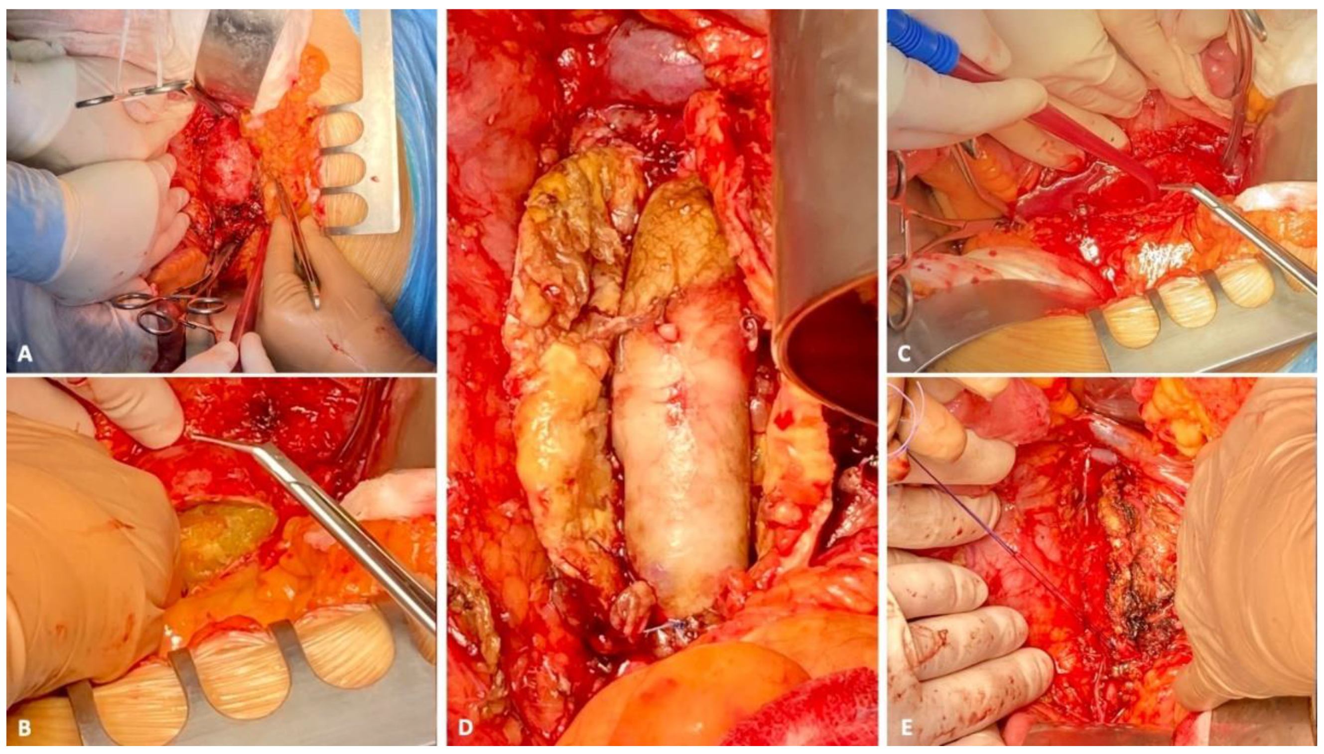 Uro 02 00002 g004 Uro 02 00002 g004