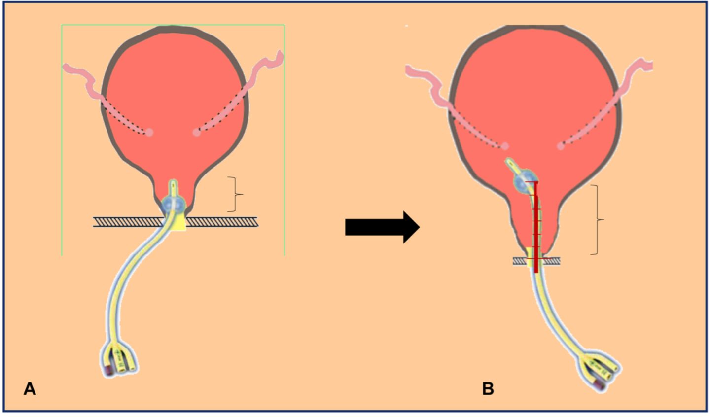 Uro 02 00011 g002 550