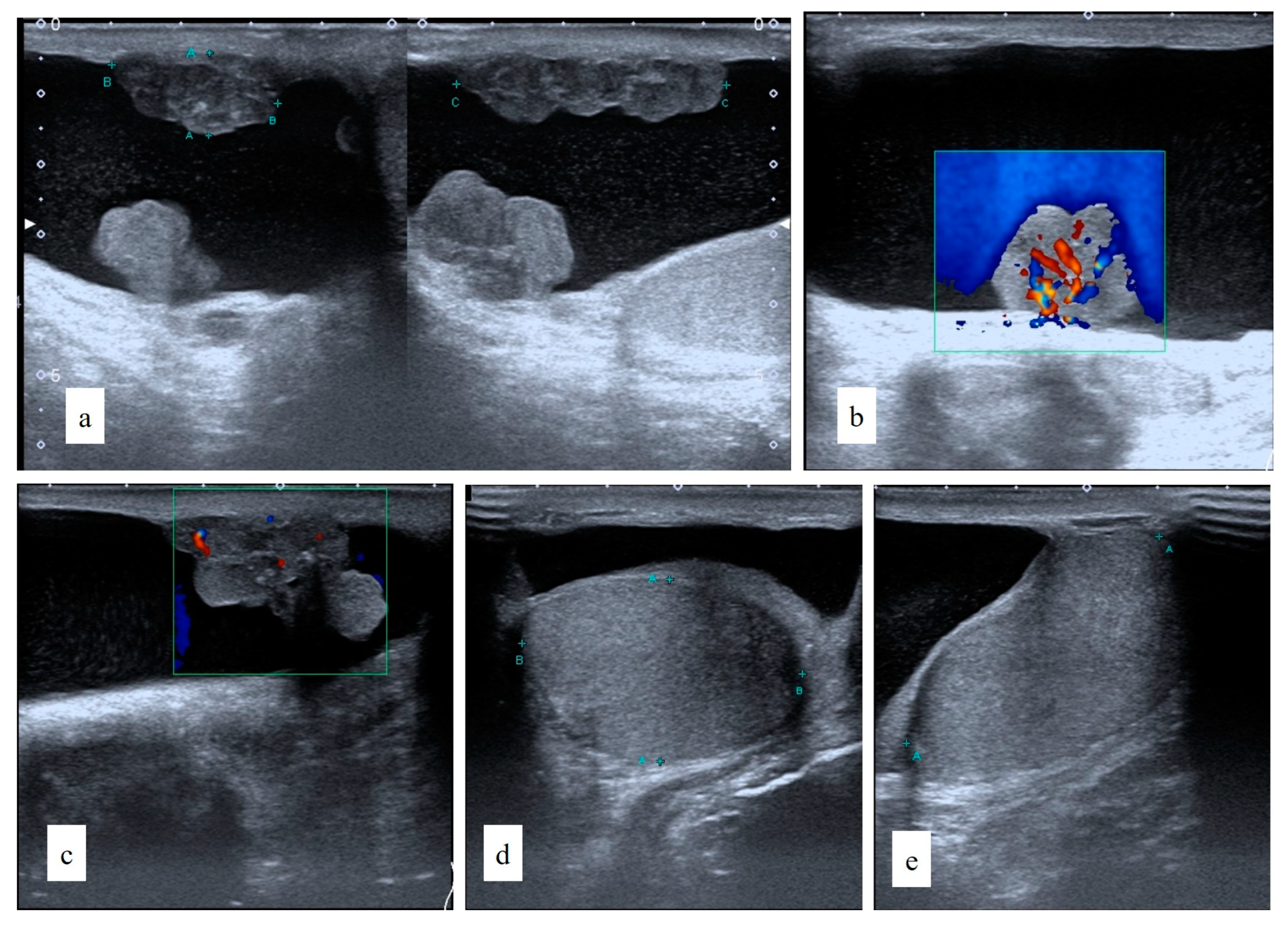 Uro 02 00031 g001 Uro 02 00031 g001