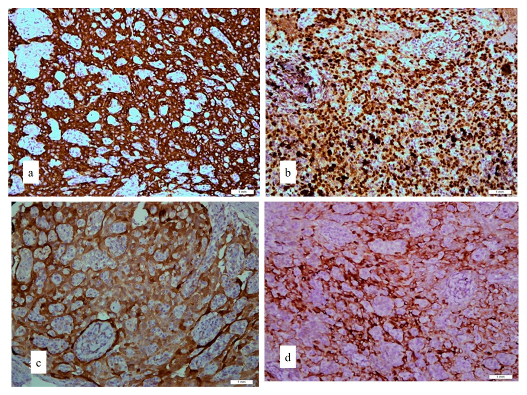 Uro 02 00031 g003 Uro 02 00031 g003