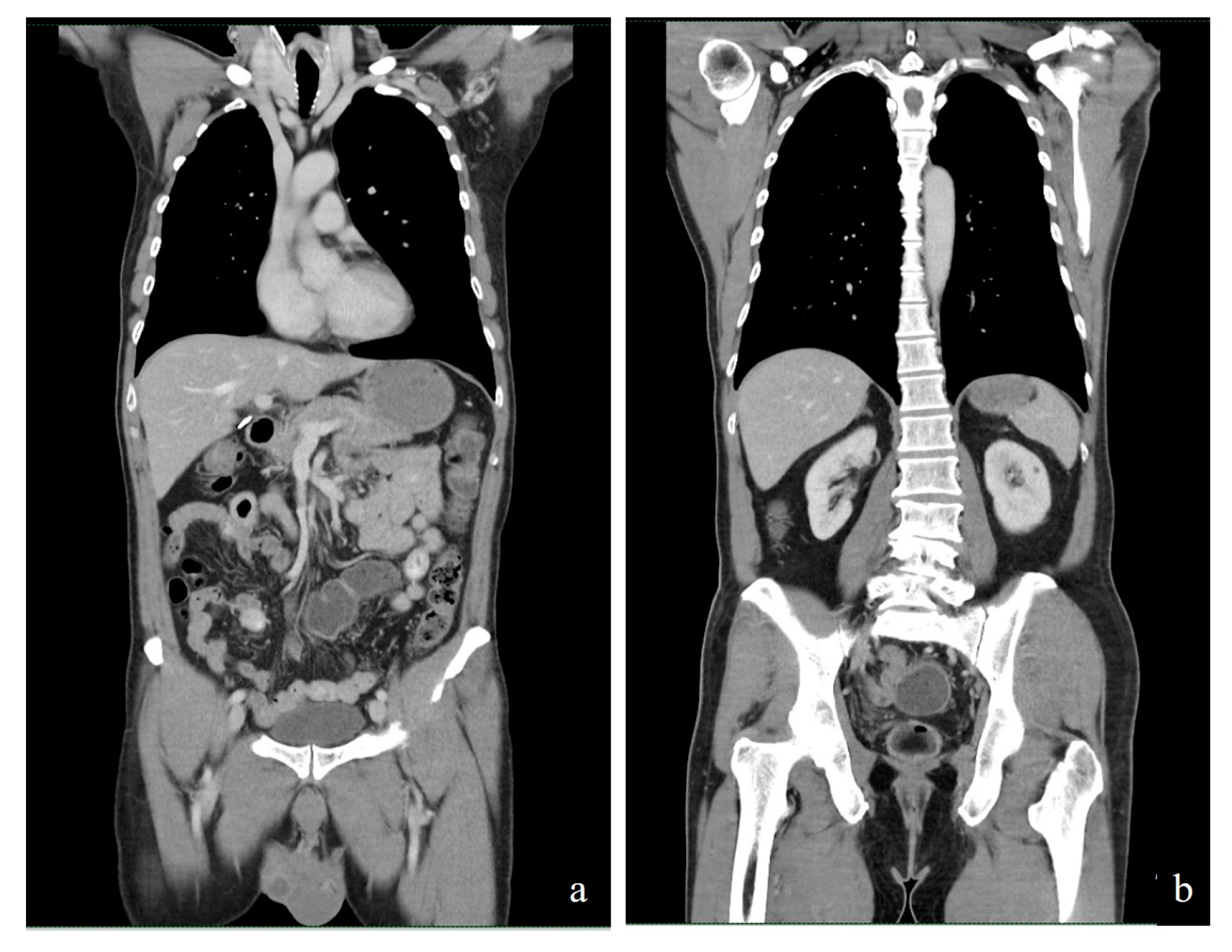 Uro 02 00031 g004 Uro 02 00031 g004