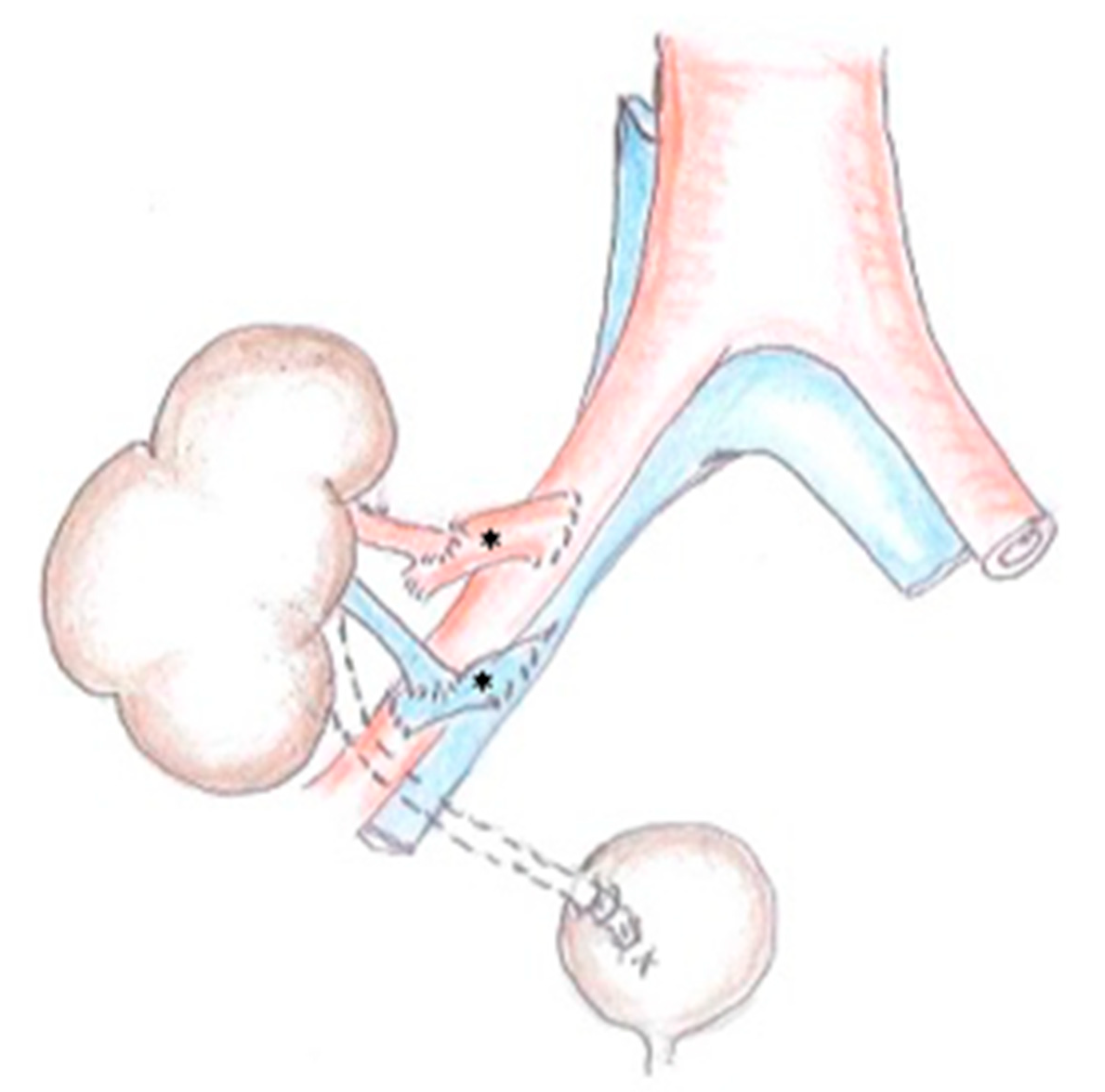 Uro 03 00020 g002 Uro 03 00020 g002