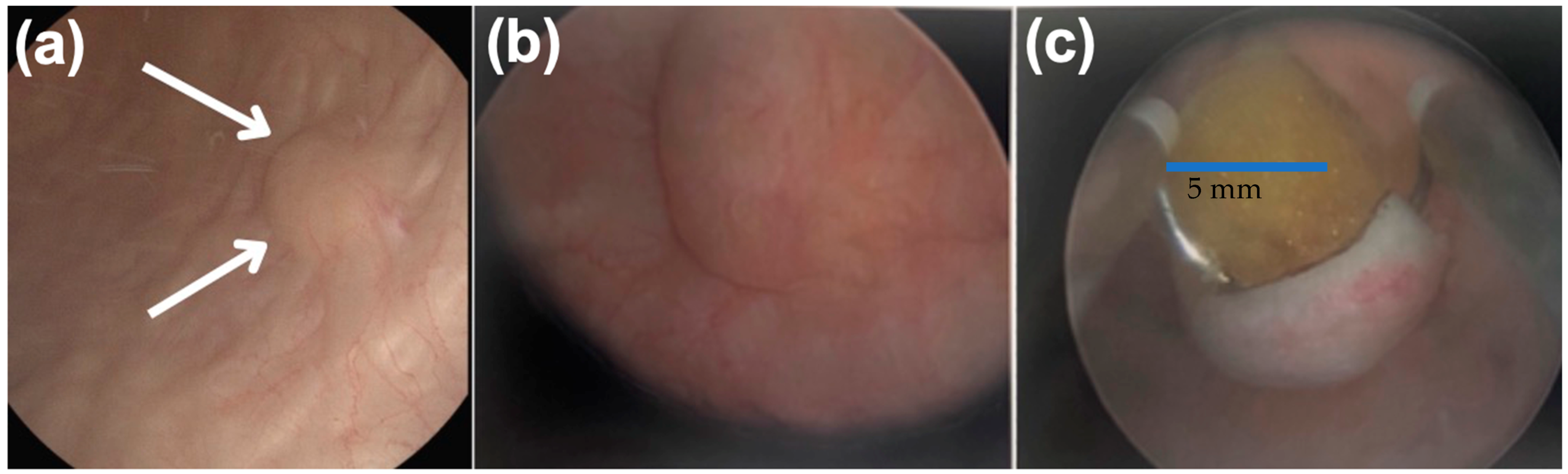 Uro 05 00015 g001 Uro 05 00015 g001