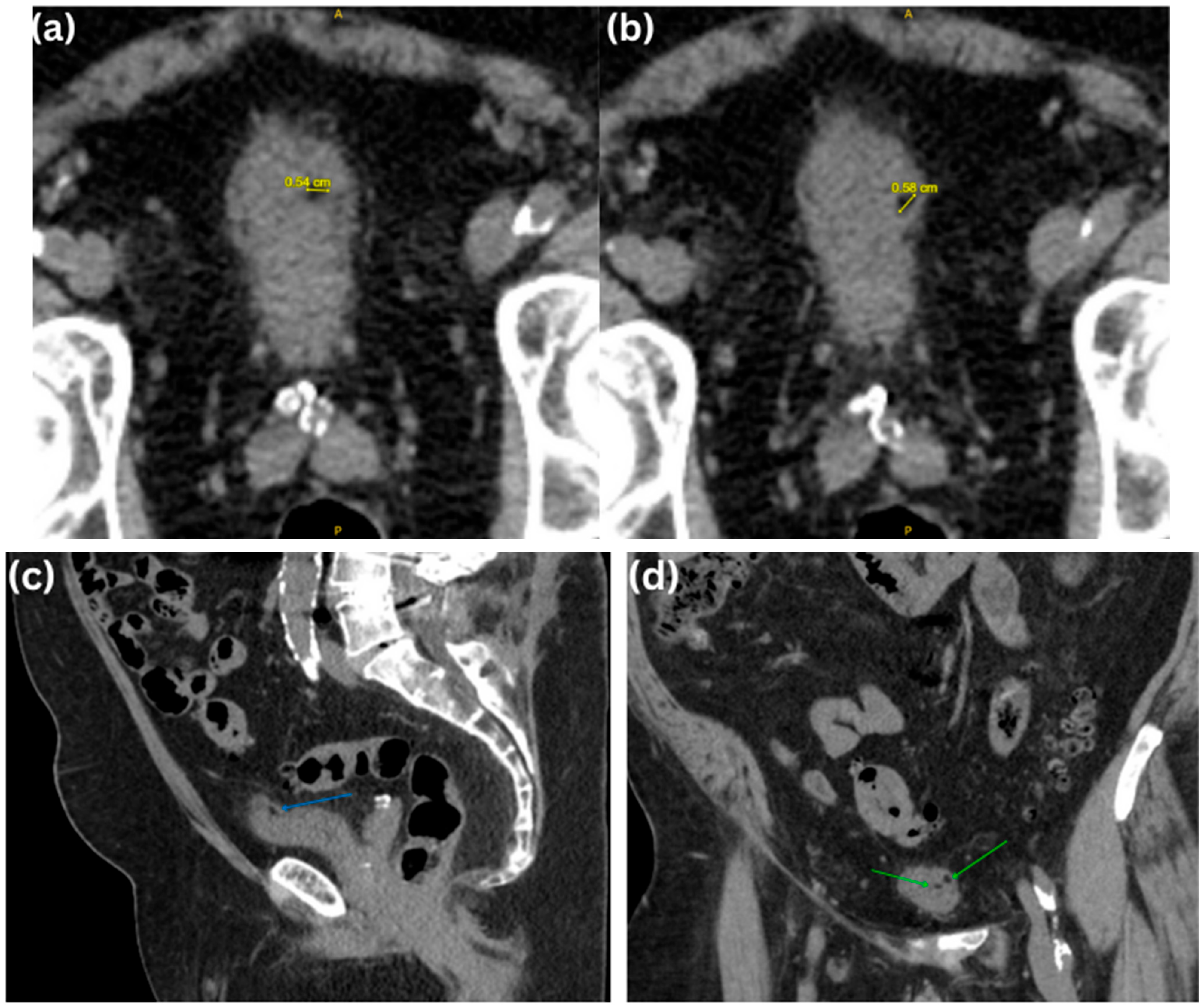 Uro 05 00015 g002 Uro 05 00015 g002