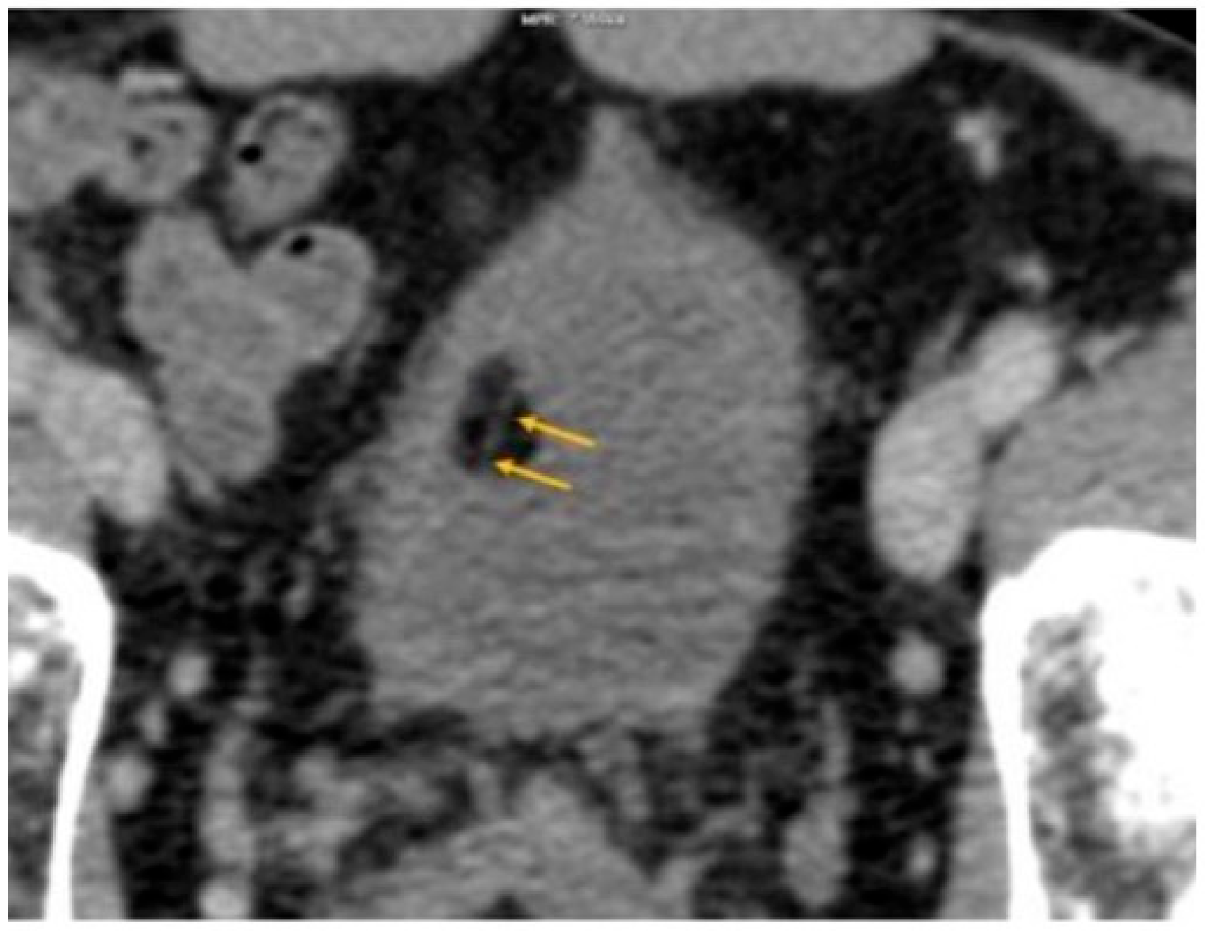 Uro 05 00015 g005 Uro 05 00015 g005