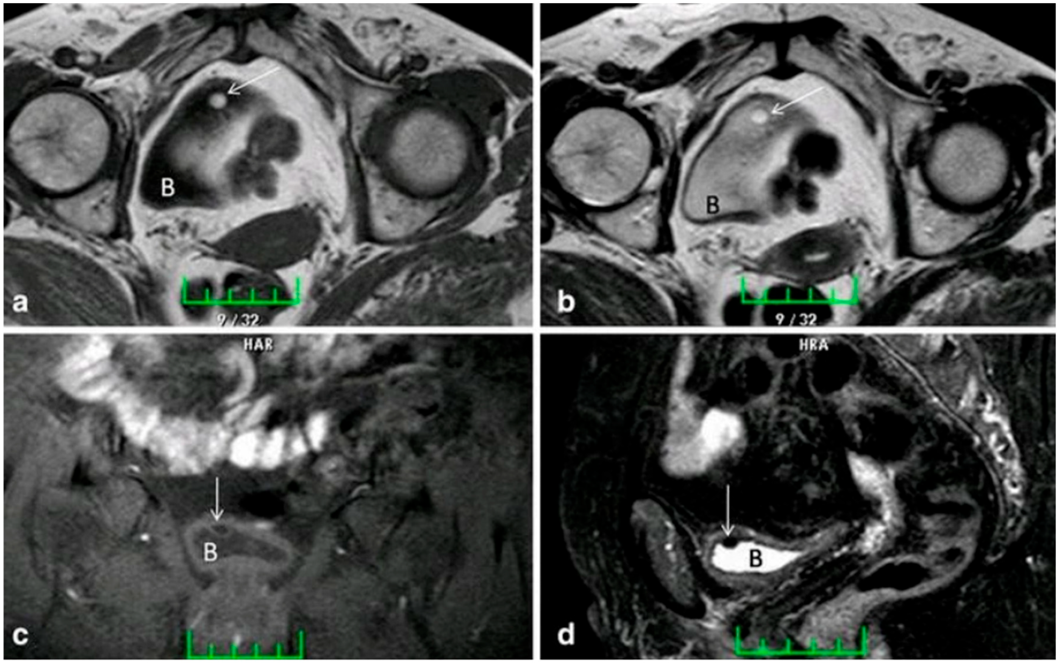 Uro 05 00015 g006 Uro 05 00015 g006