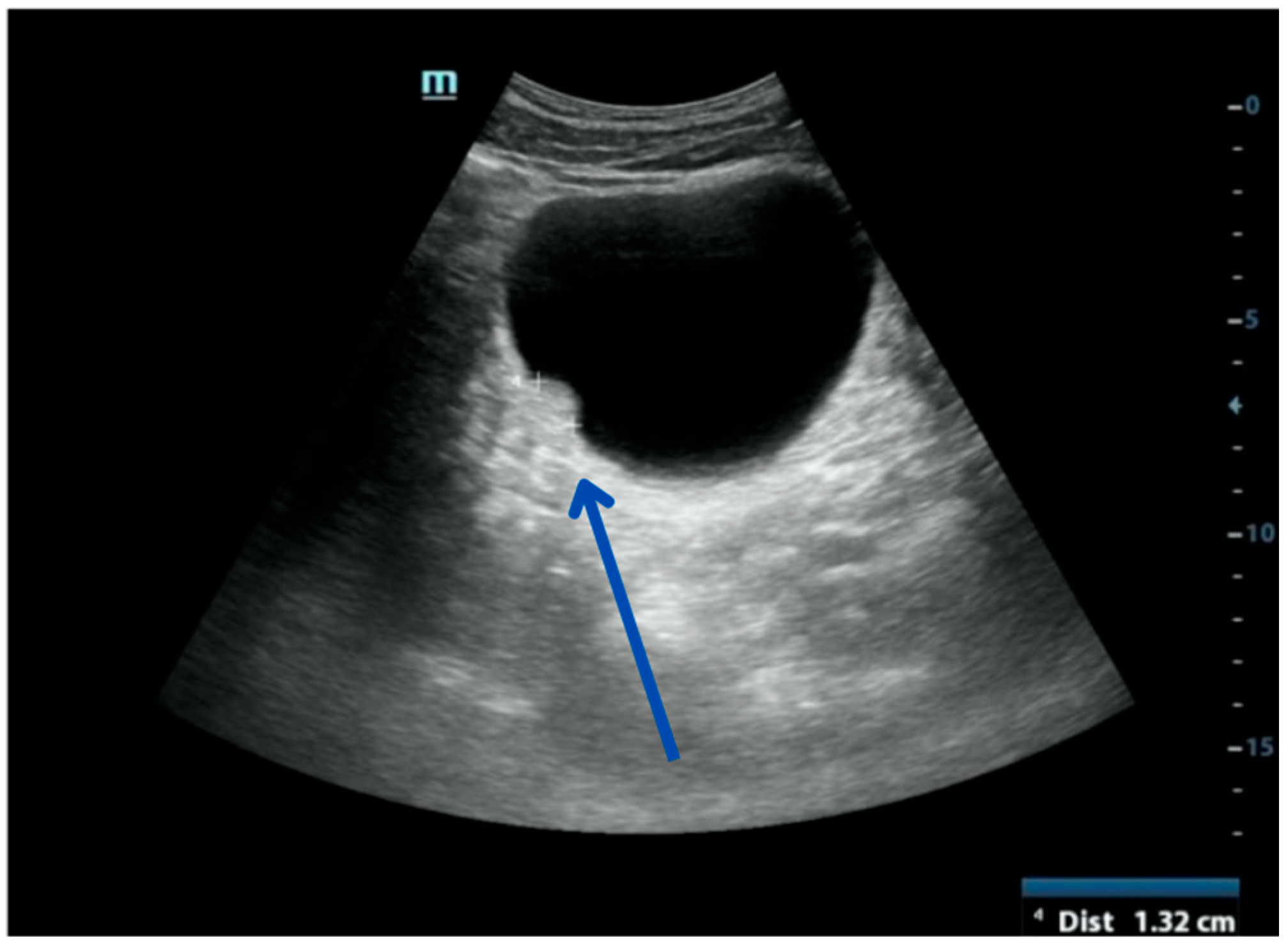 Uro 05 00015 g007 Uro 05 00015 g007