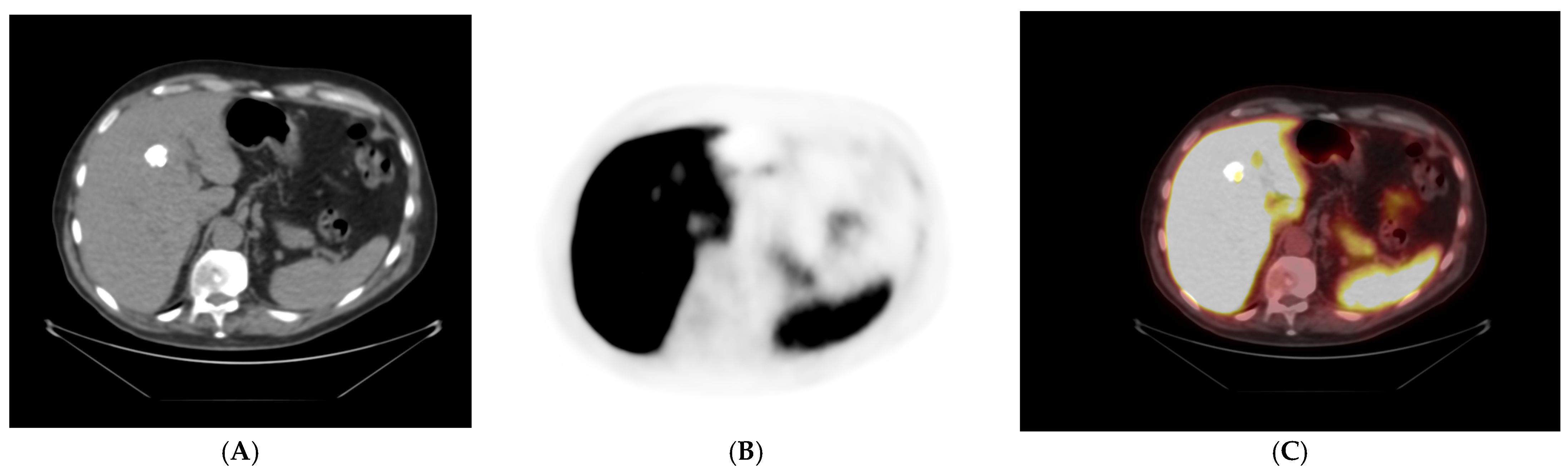 Uro 06 00017 g009