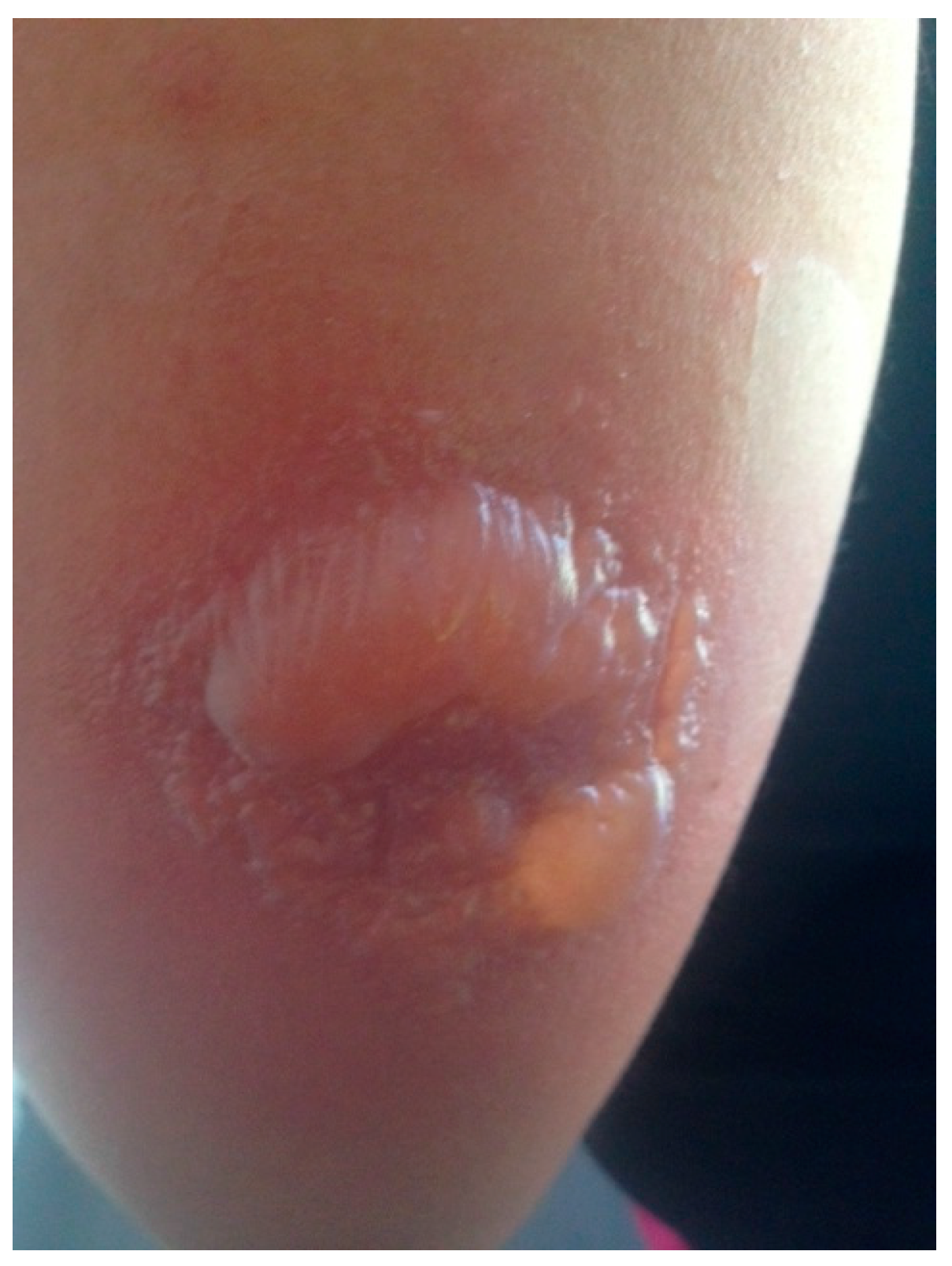 Vaccines 05 00026 g002