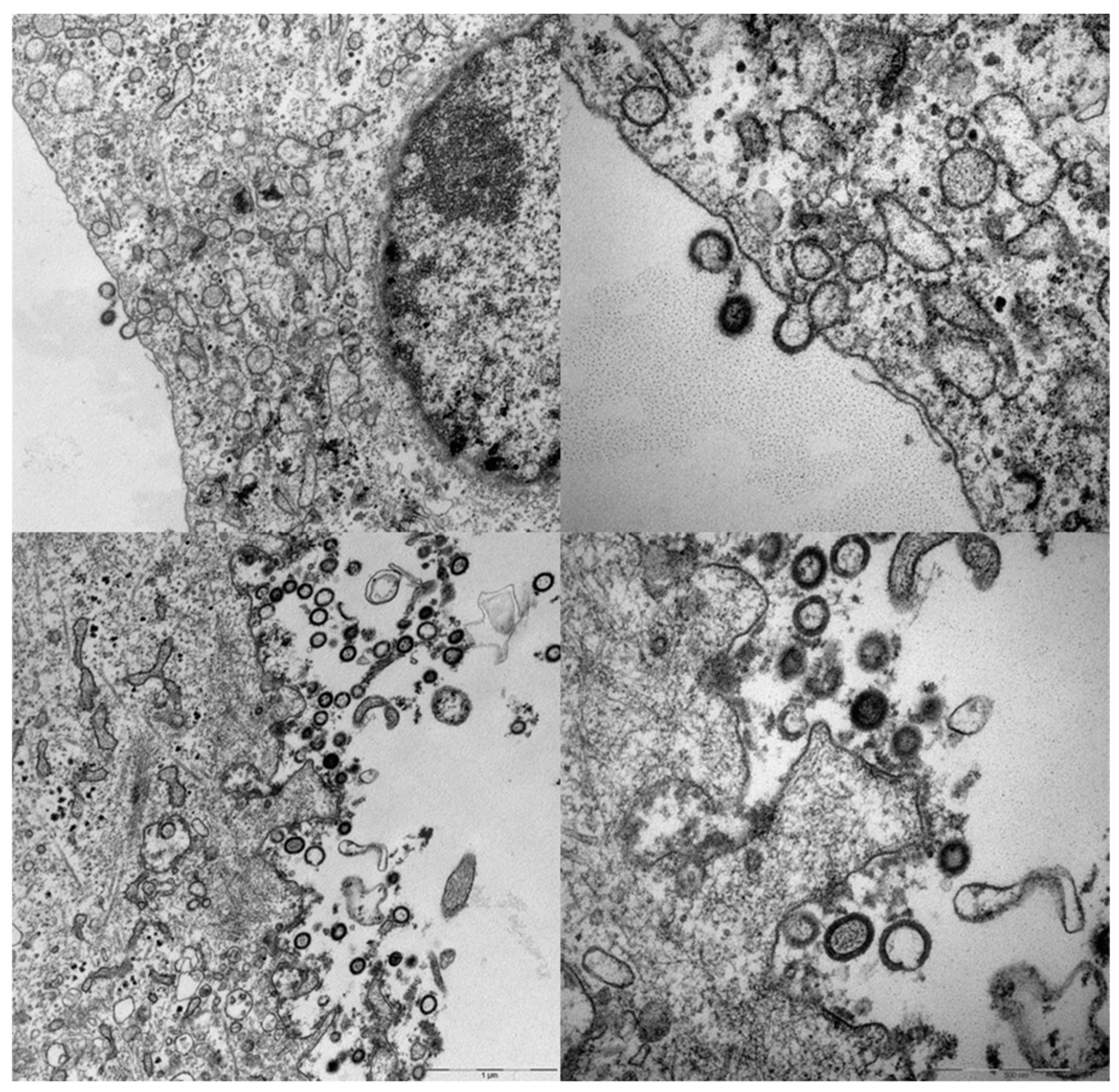 Vaccines 06 00010 g003 Vaccines 06 00010 g003