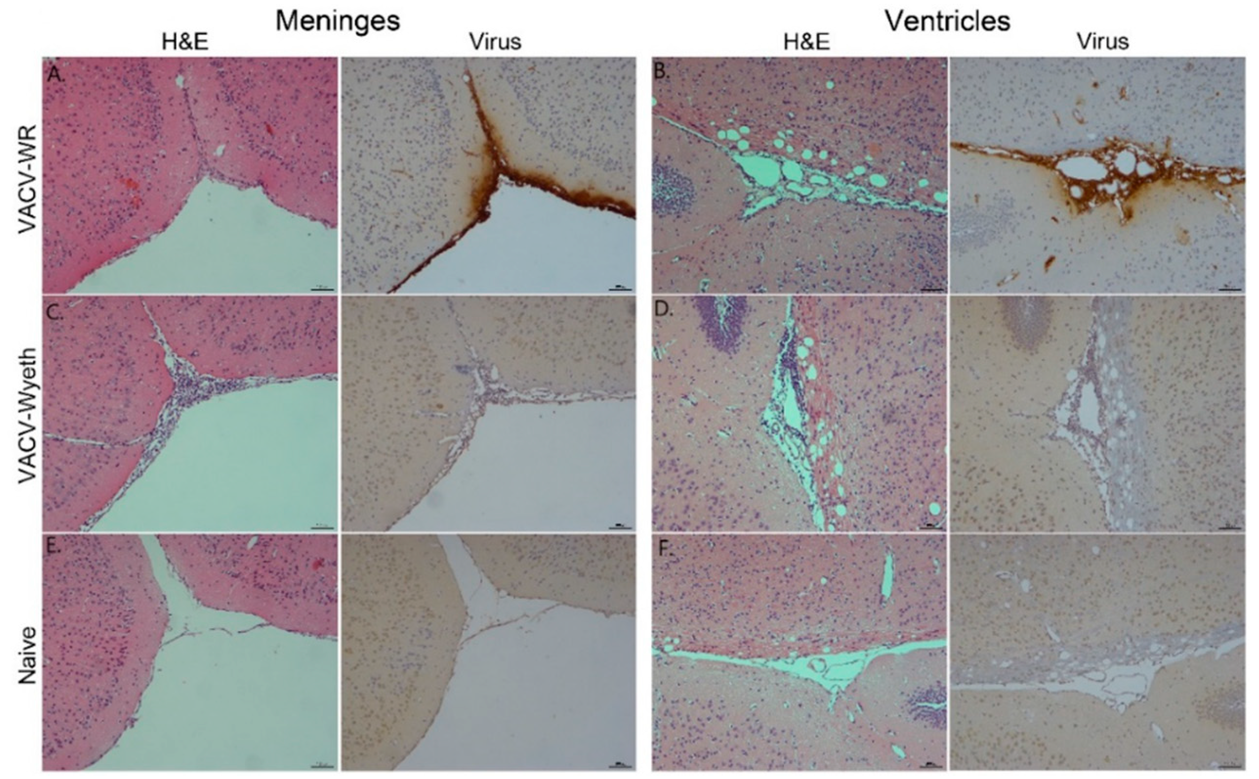 Vaccines 07 00019 g002 550