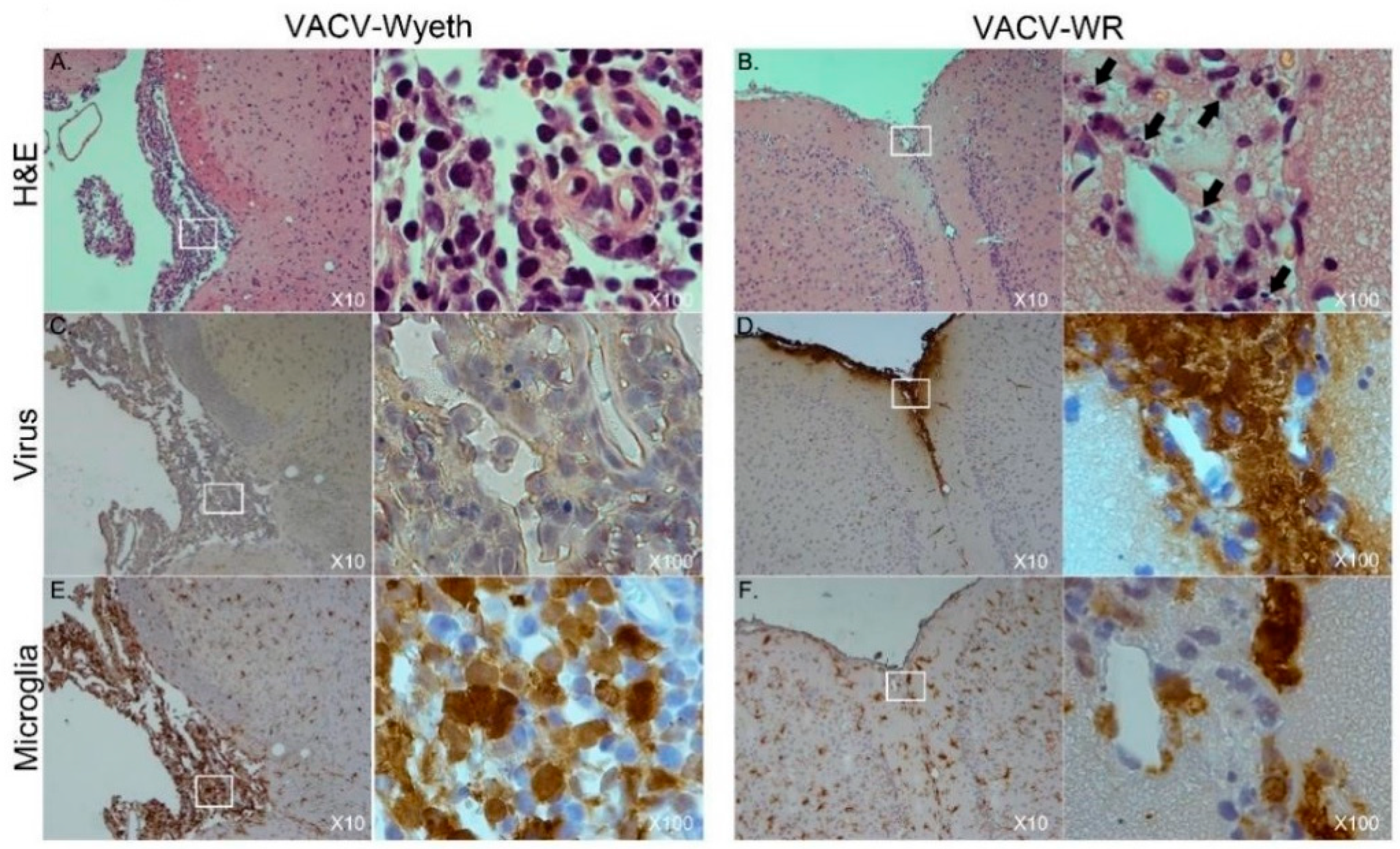 Vaccines 07 00019 g003 550