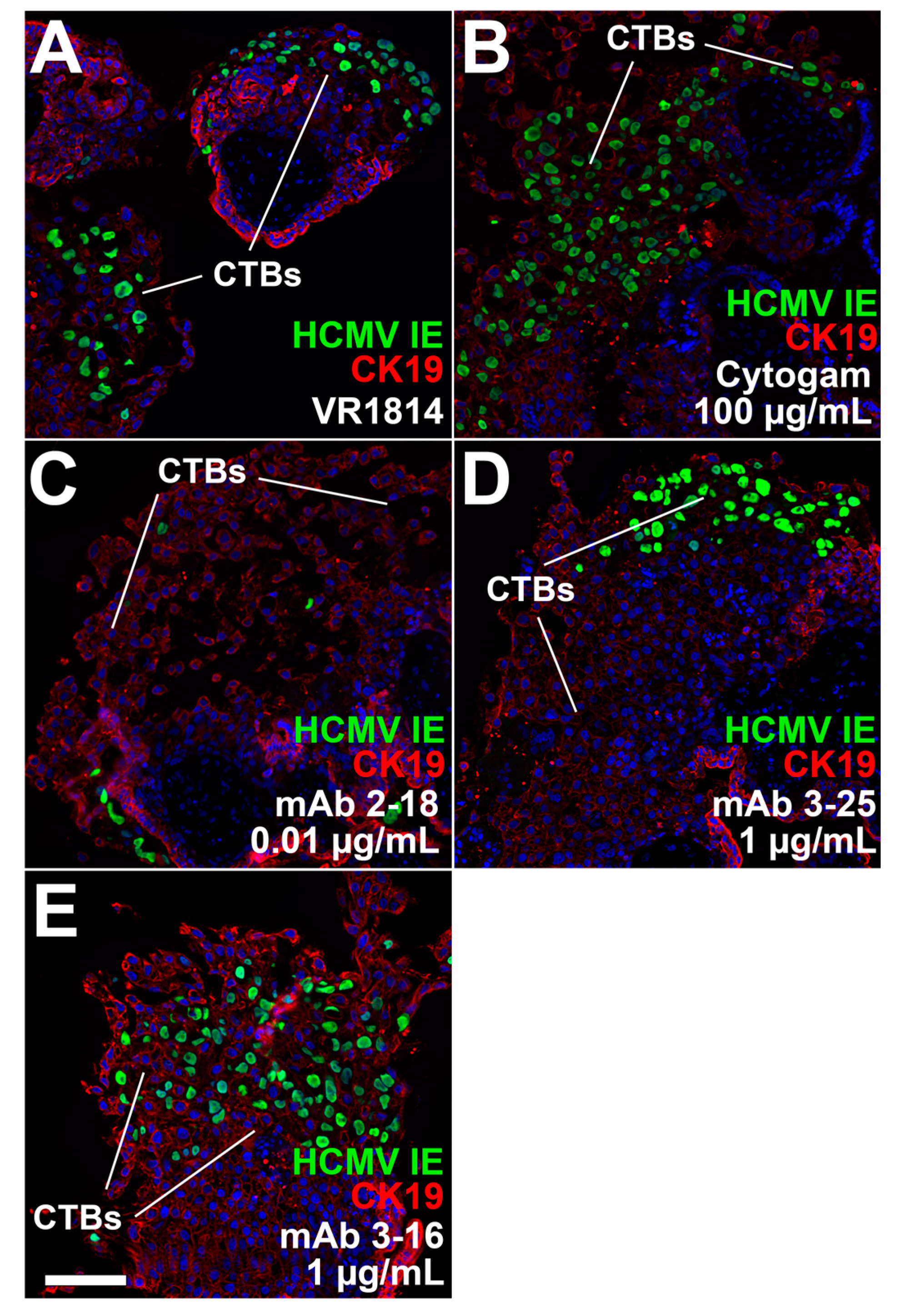 Vaccines 07 00135 g005 Vaccines 07 00135 g005