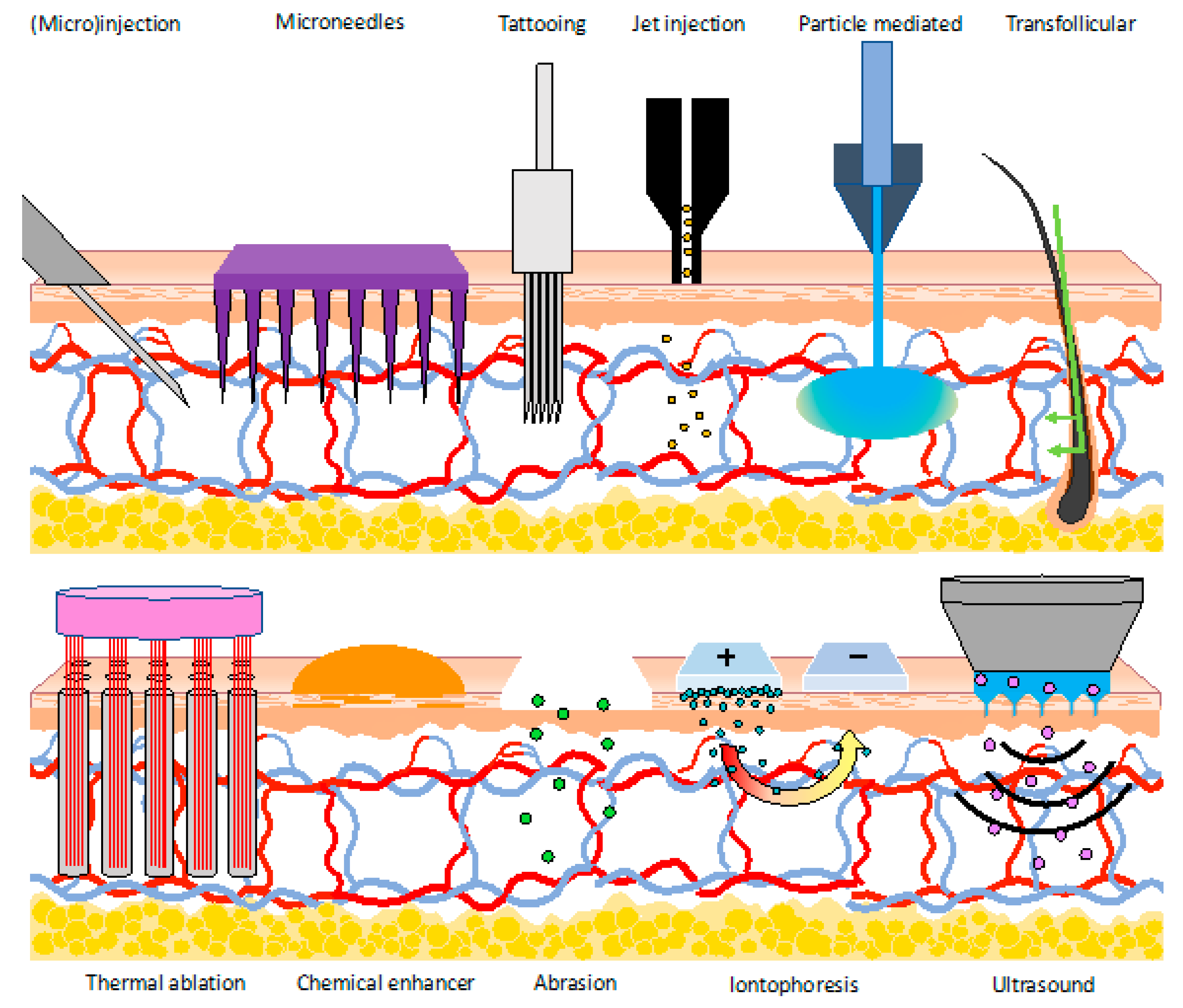 Vaccines | Free Full-Text | Vaccination into the Dermal 
