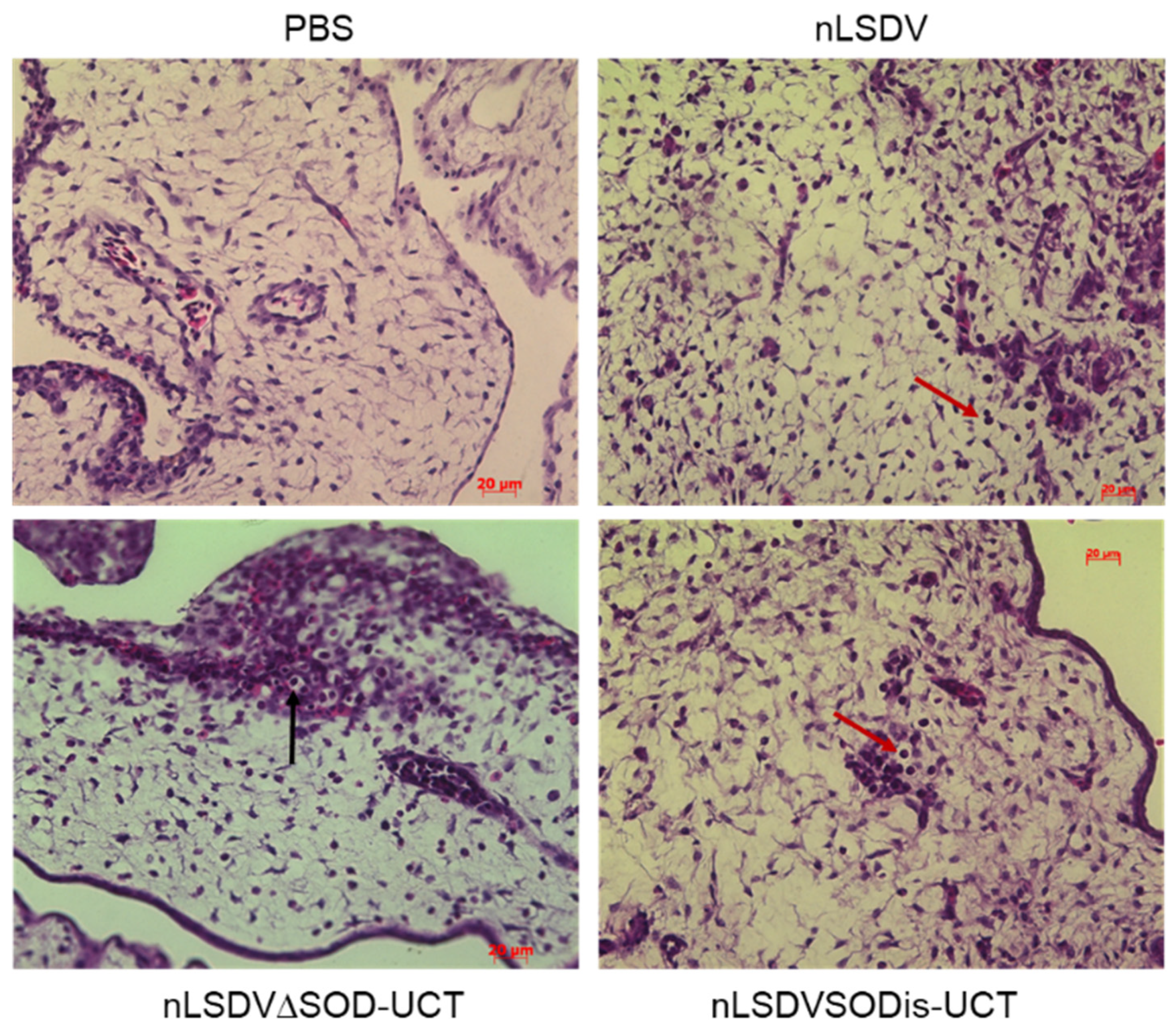 Vaccines 08 00664 g005 Vaccines 08 00664 g005