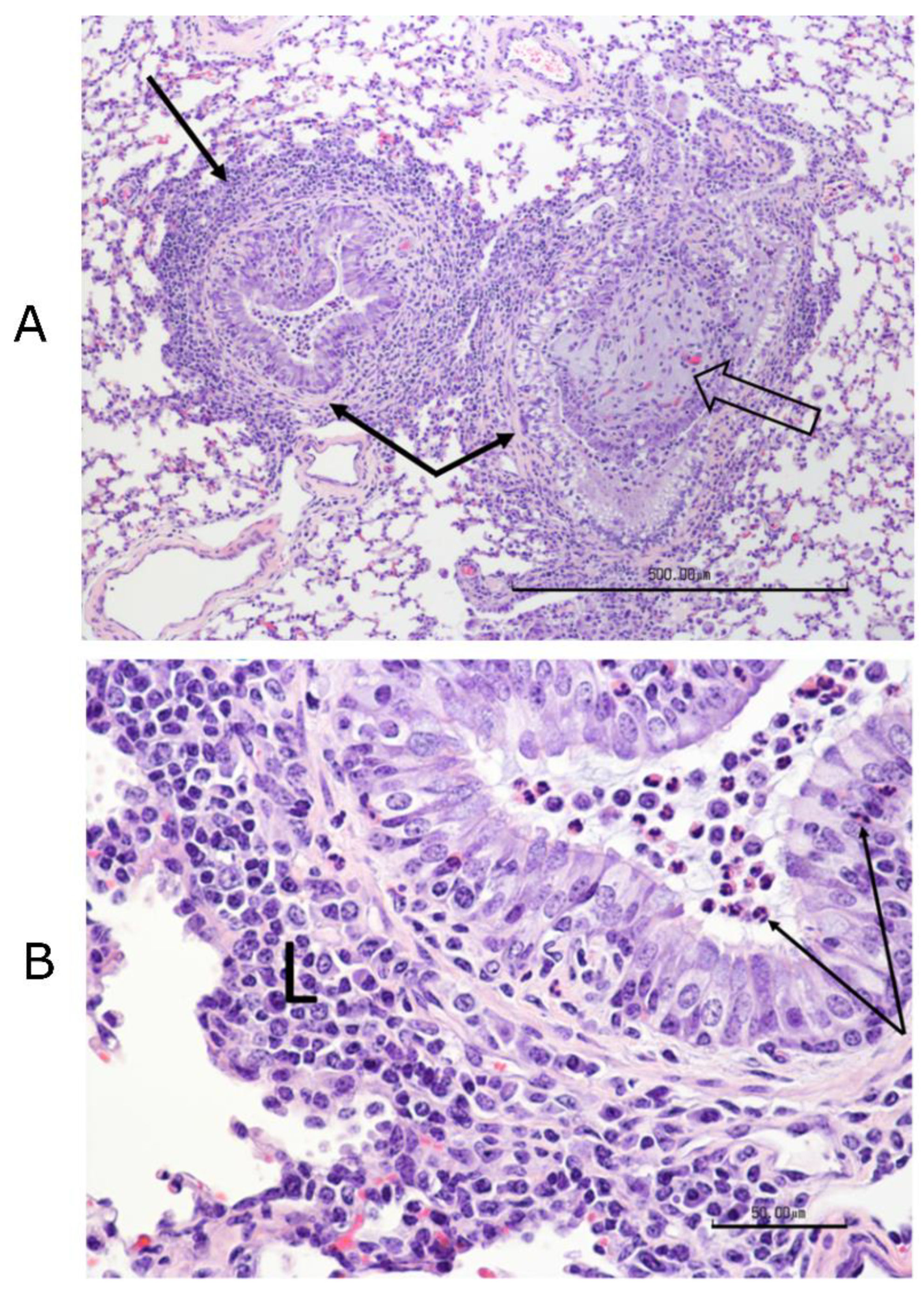 Vaccines 09 00046 g012