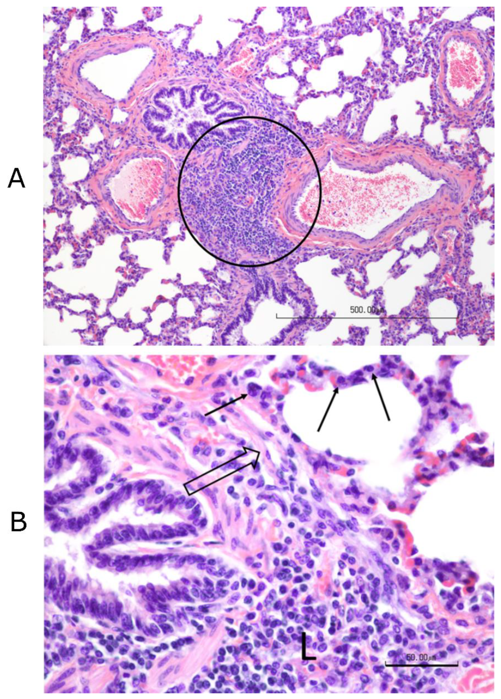 Vaccines 09 00046 g013