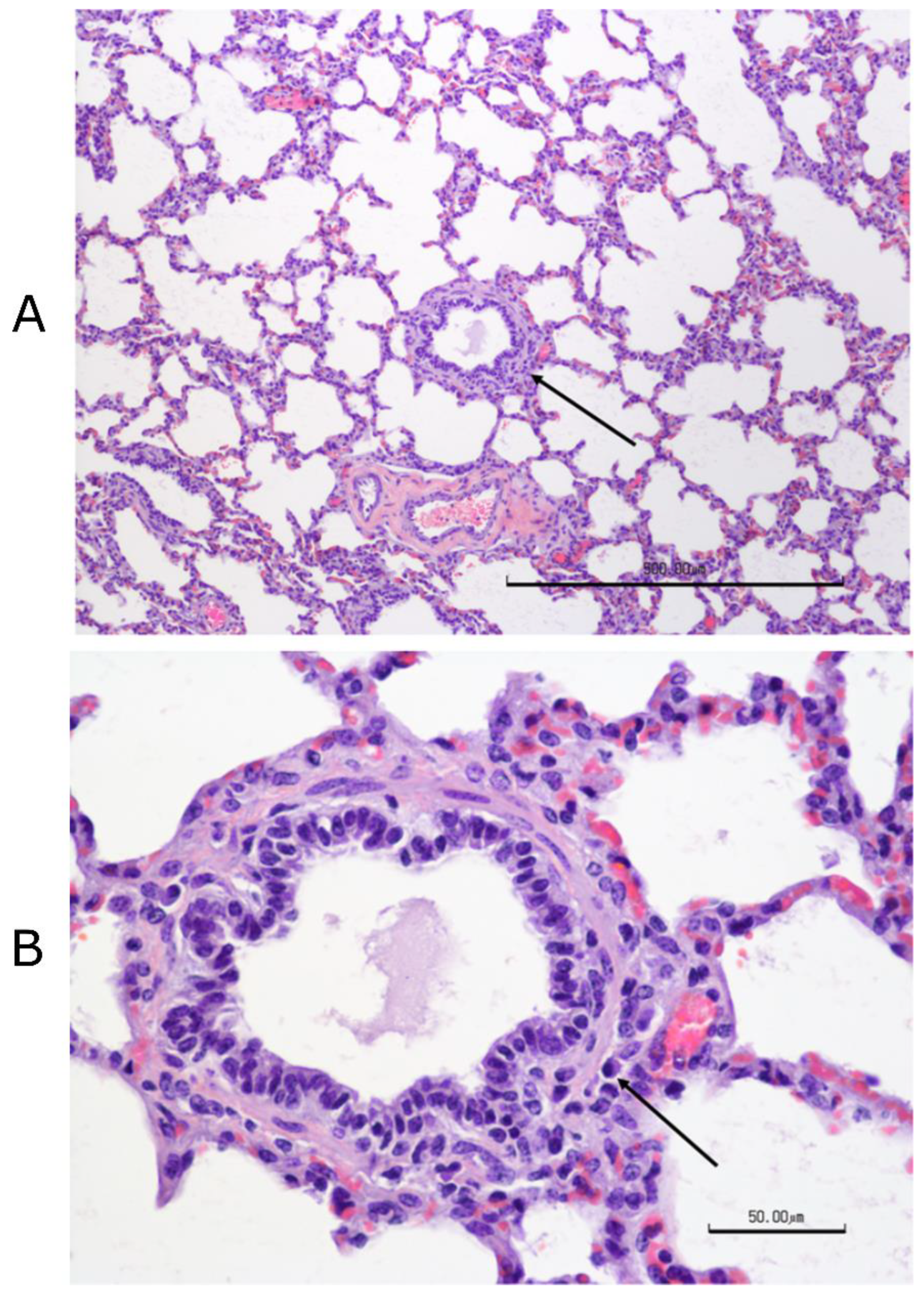 Vaccines 09 00046 g014
