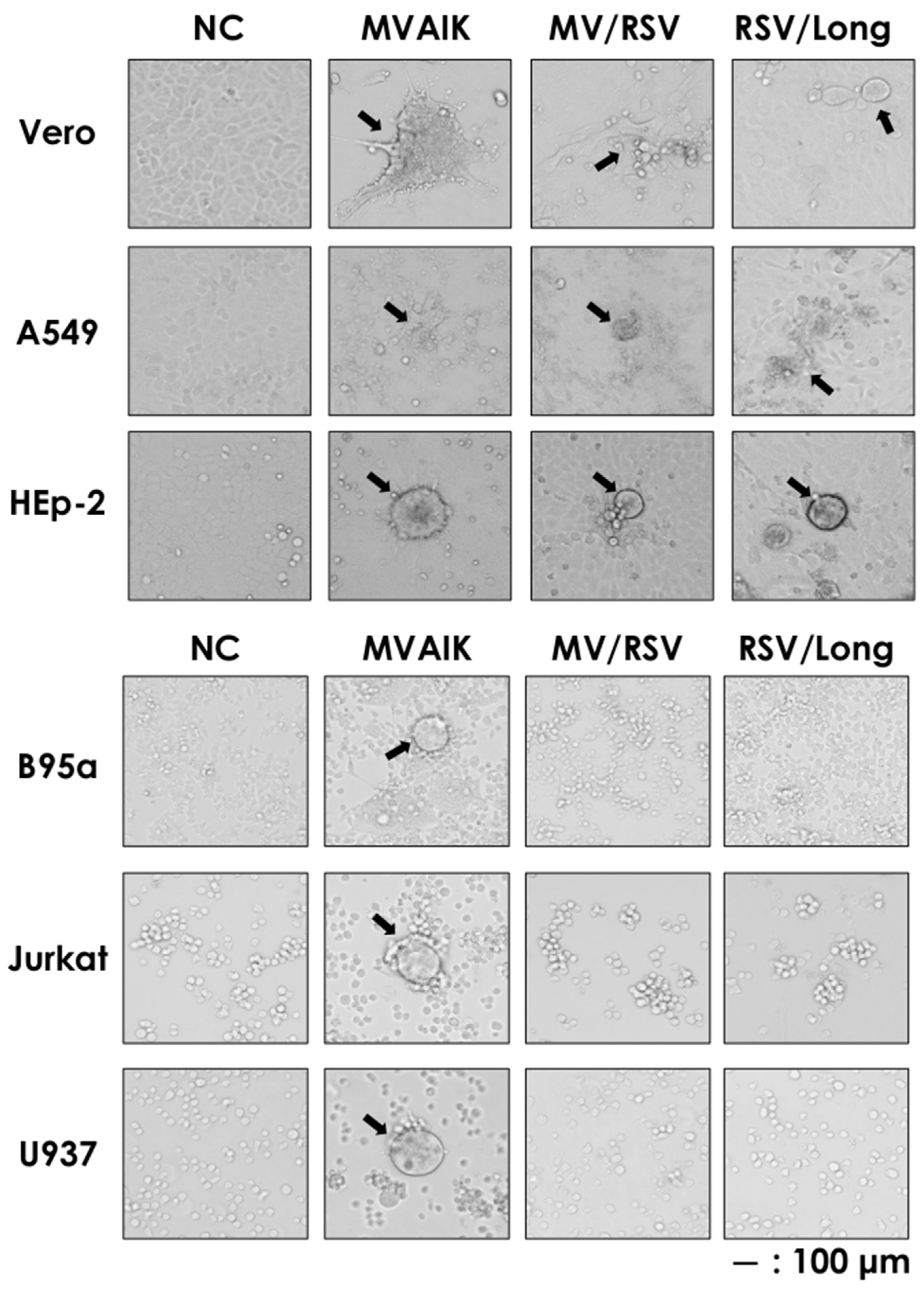 Vaccines 09 00156 g005 Vaccines 09 00156 g005