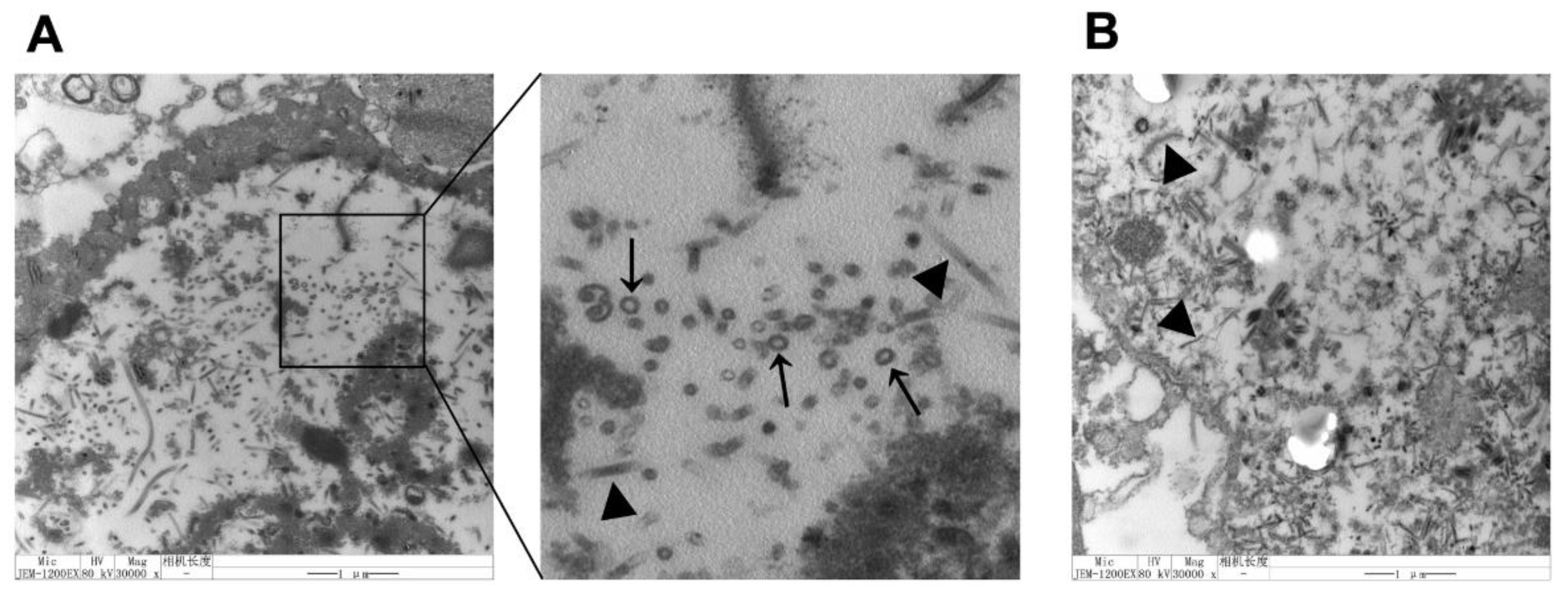 Vaccines 09 00350 g002 Vaccines 09 00350 g002