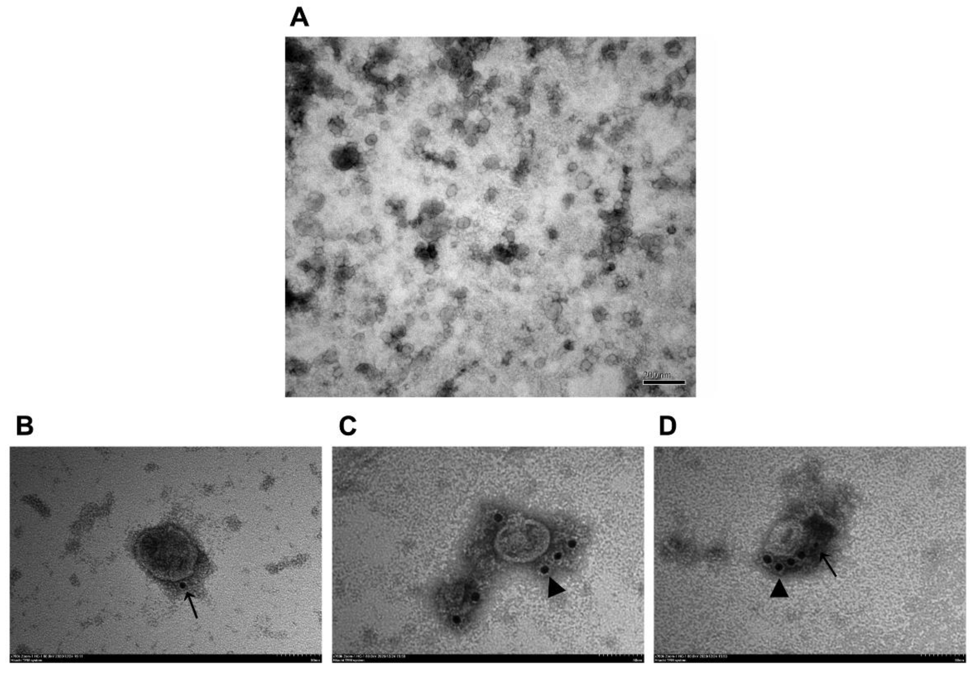 Vaccines 09 00350 g004 Vaccines 09 00350 g004