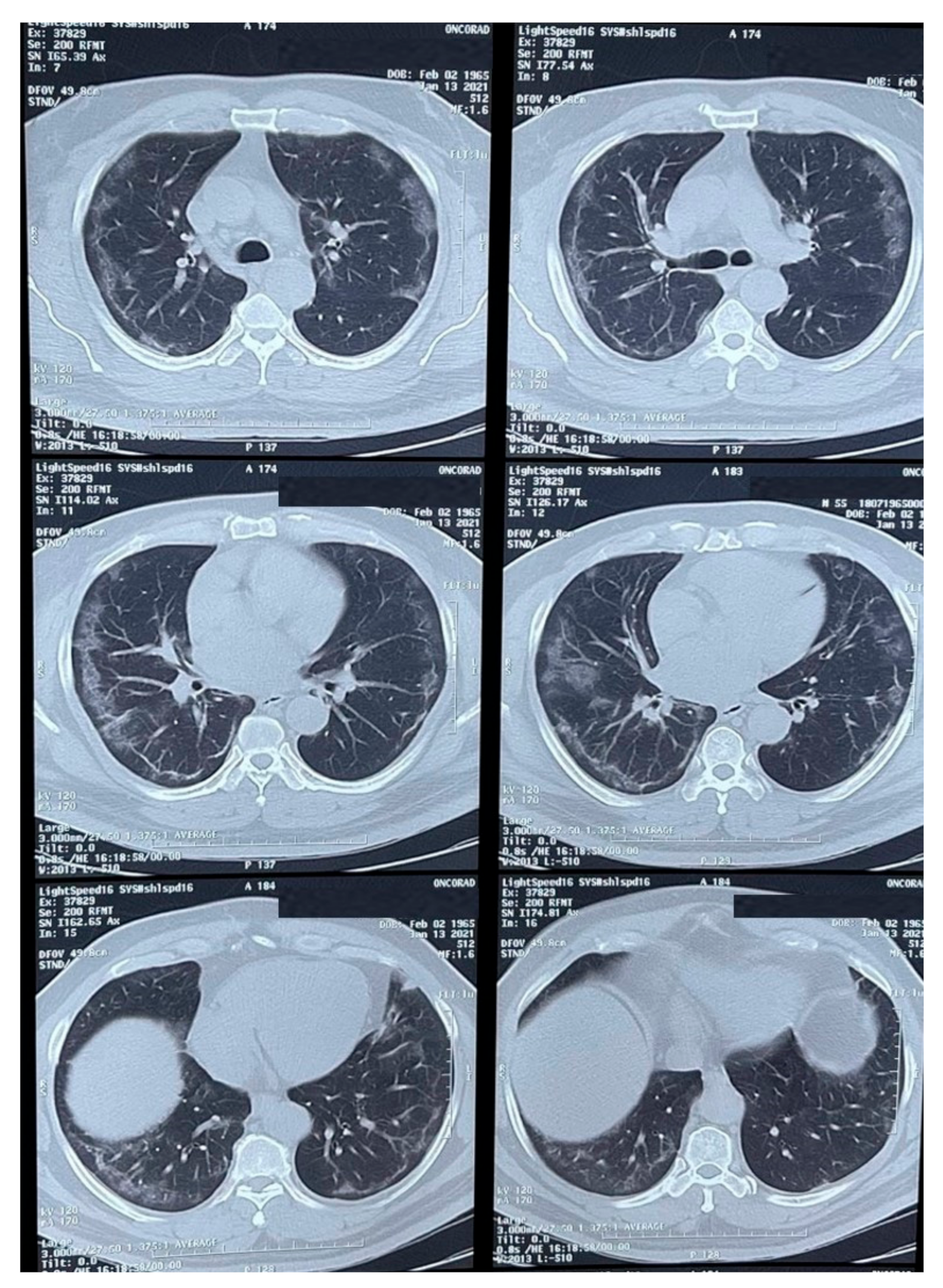 Vaccines 09 00826 g001