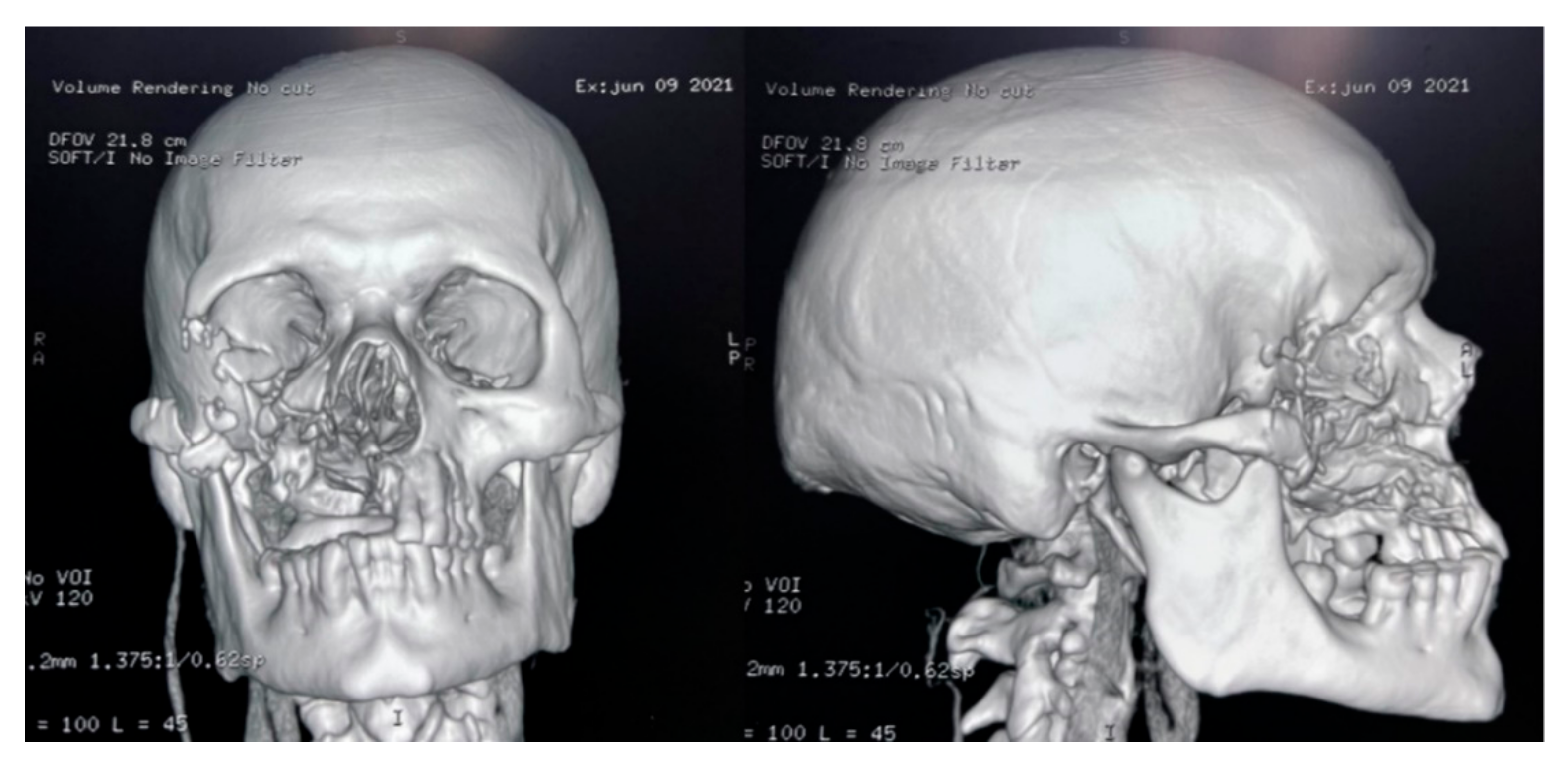 Vaccines 09 00826 g008