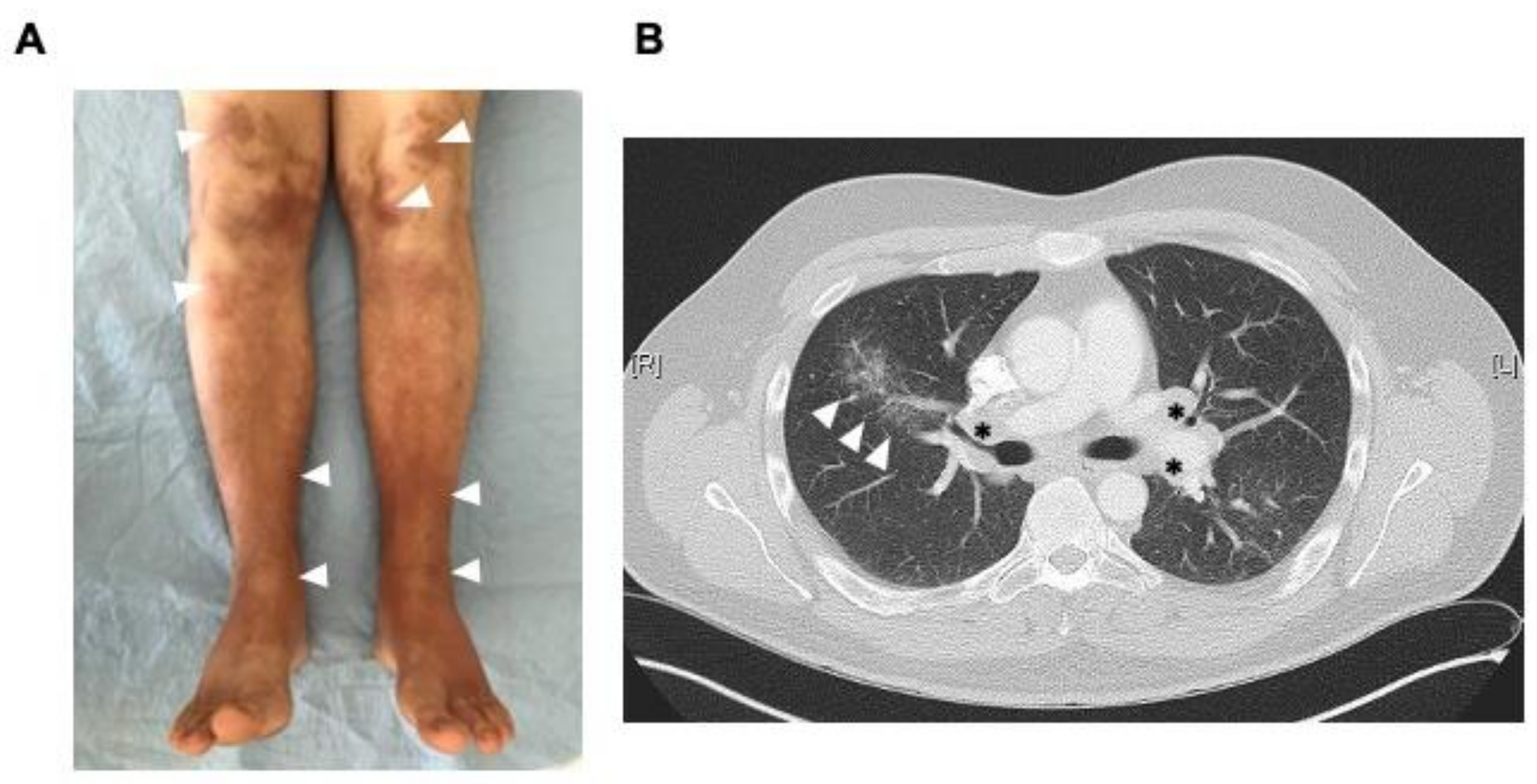 Vaccines 09 01313 g001 550
