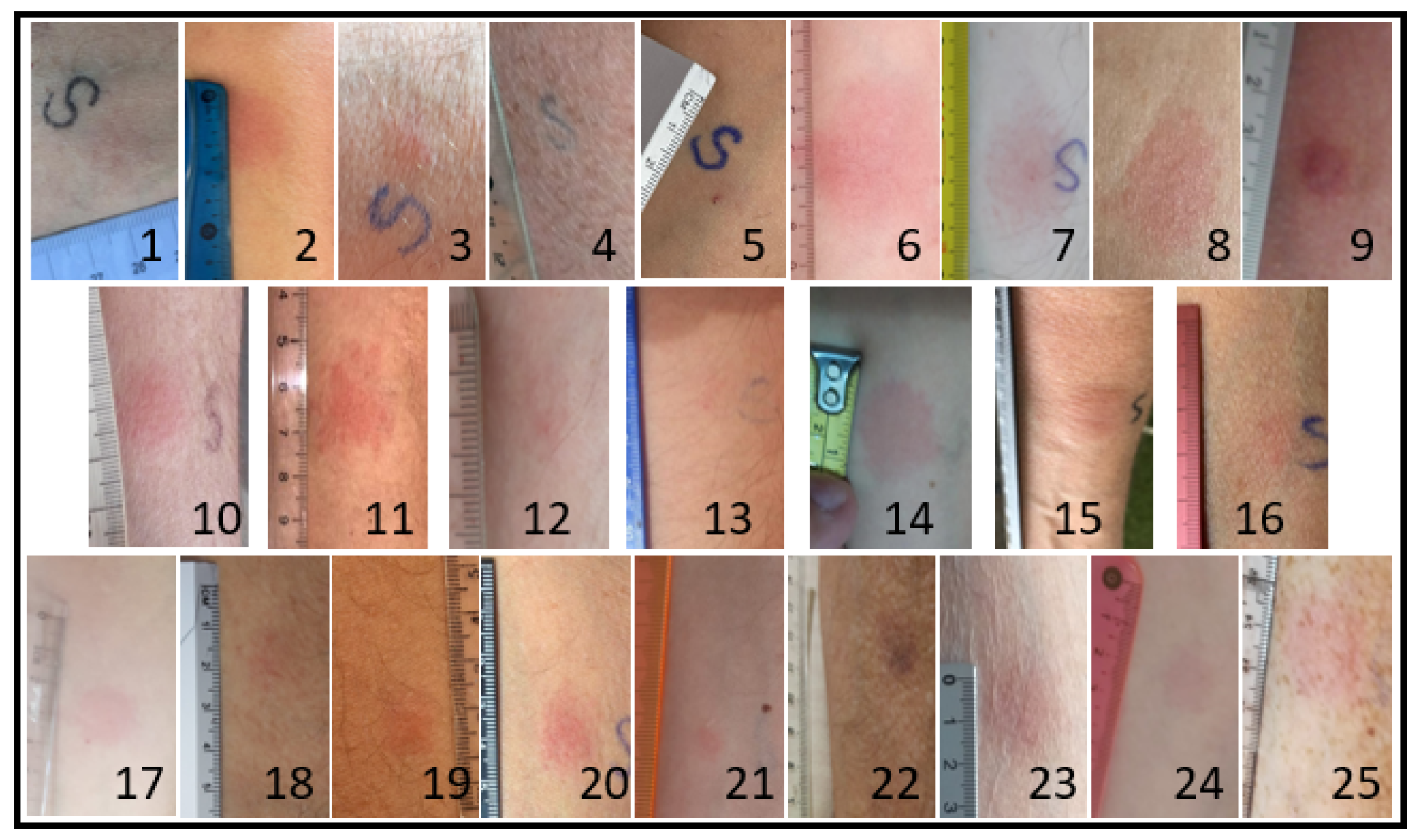 Vaccines 09 01315 g002