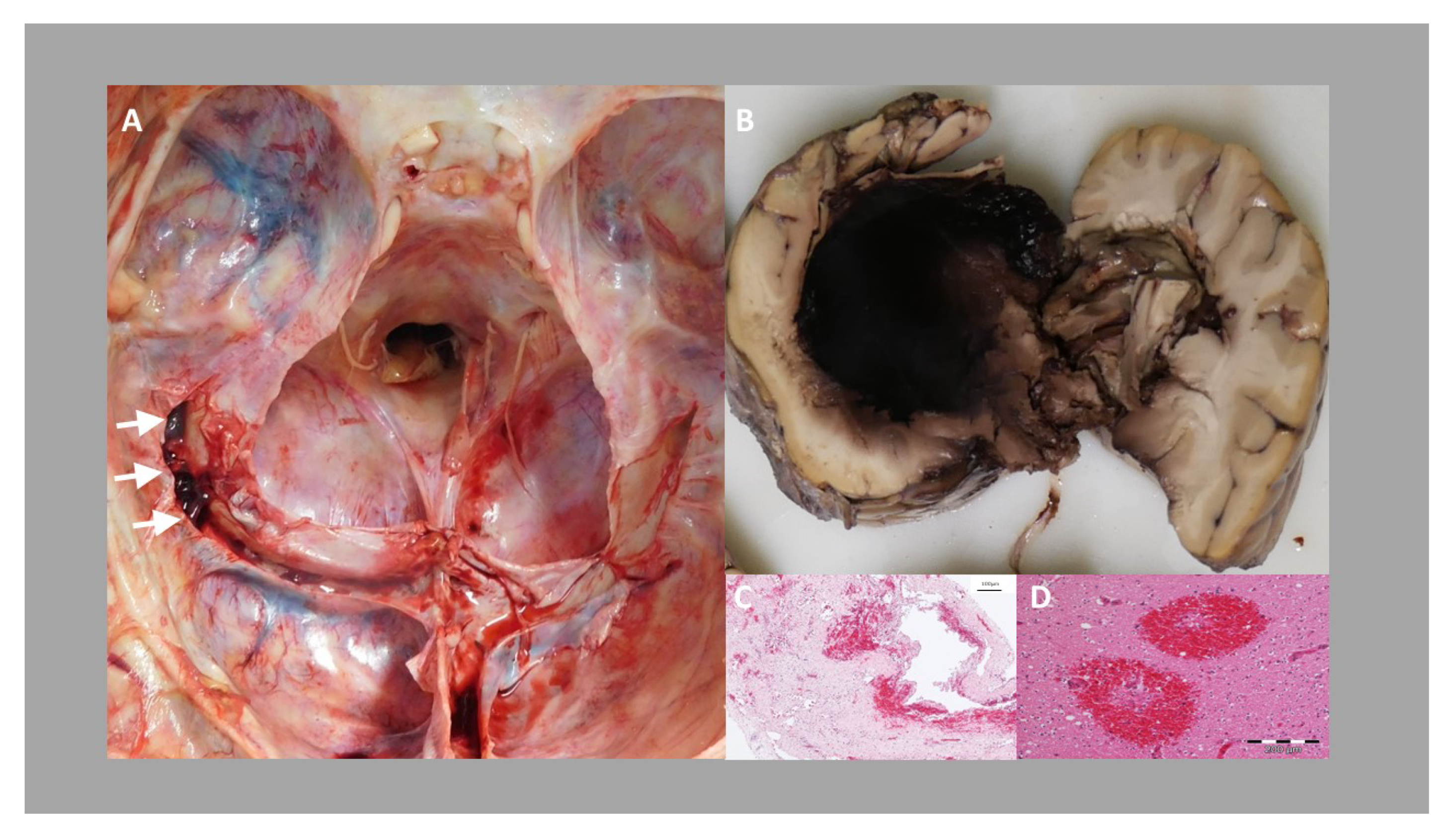 Vaccines 09 01344 g005 550