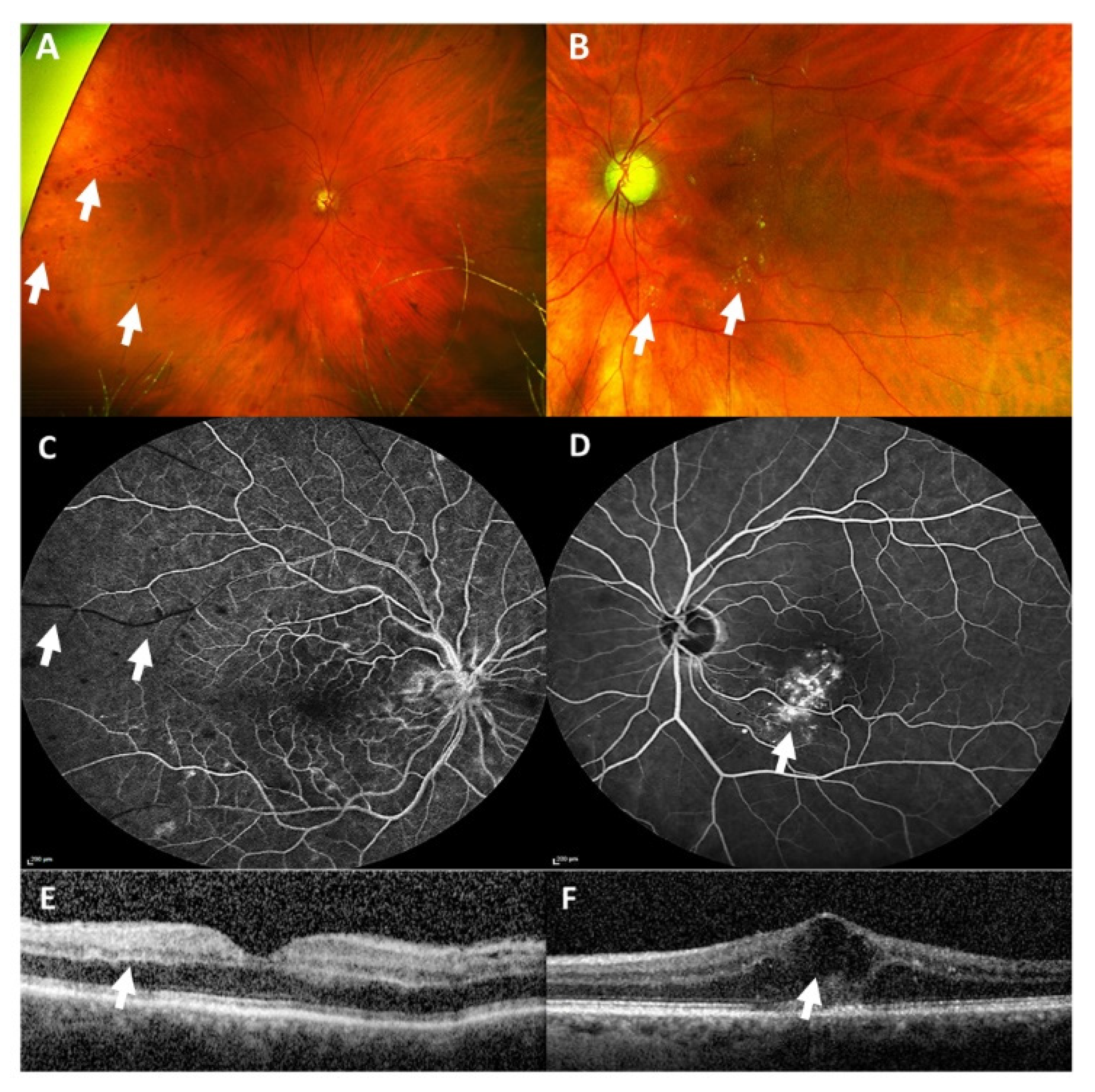 Vaccines 09 01349 g002 550