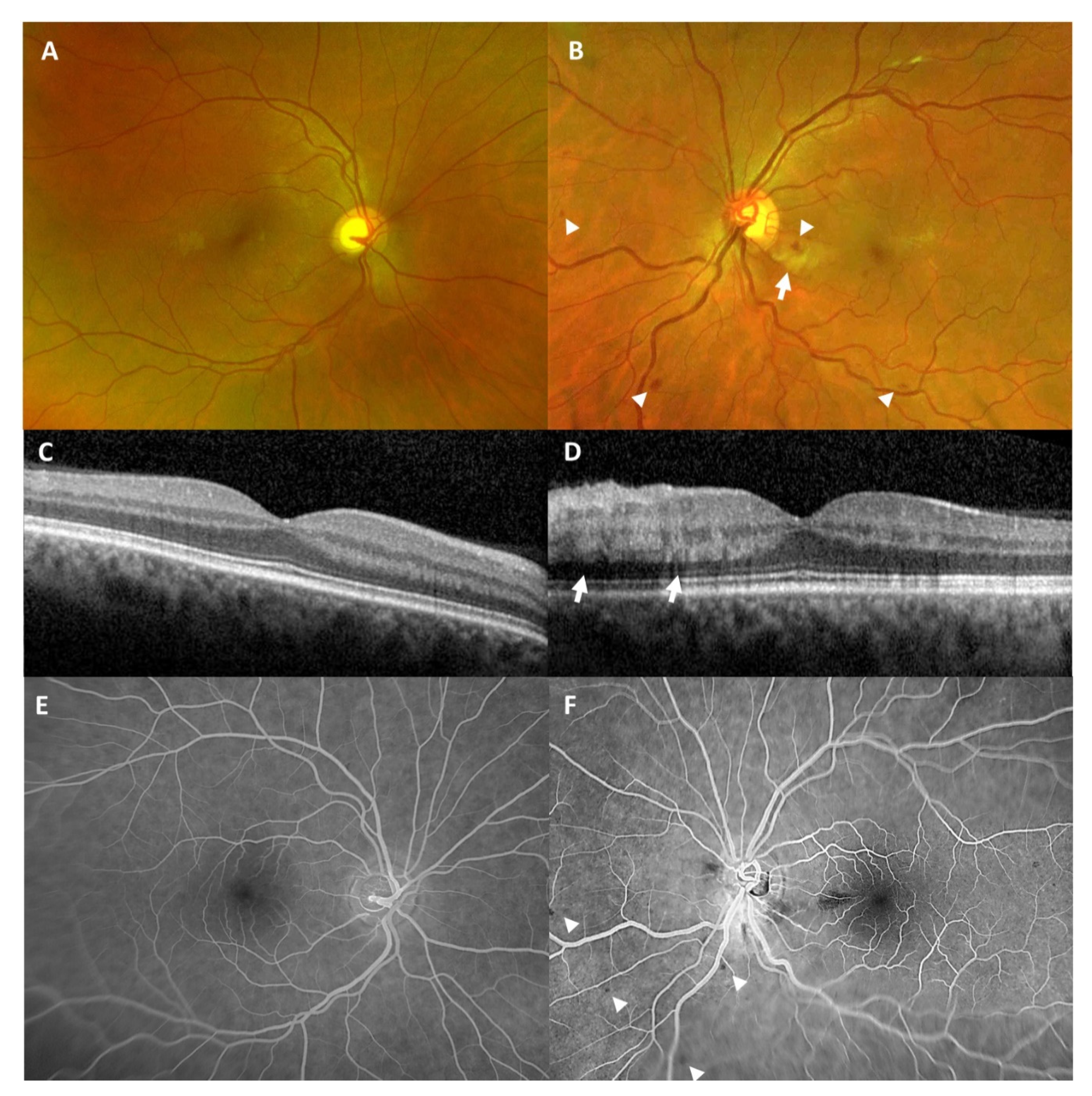 Vaccines 09 01349 g003 550