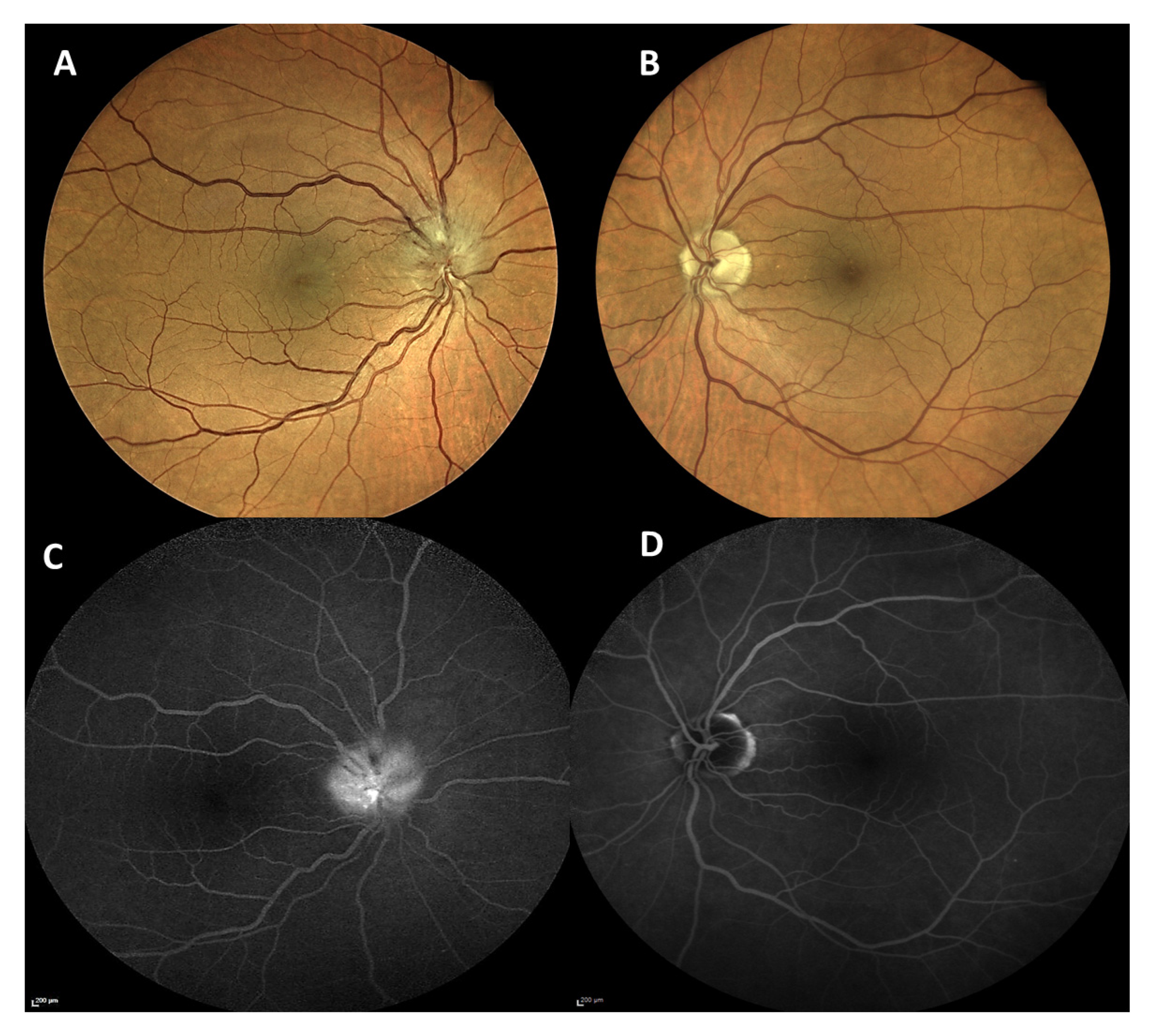 Vaccines 09 01349 g004 550