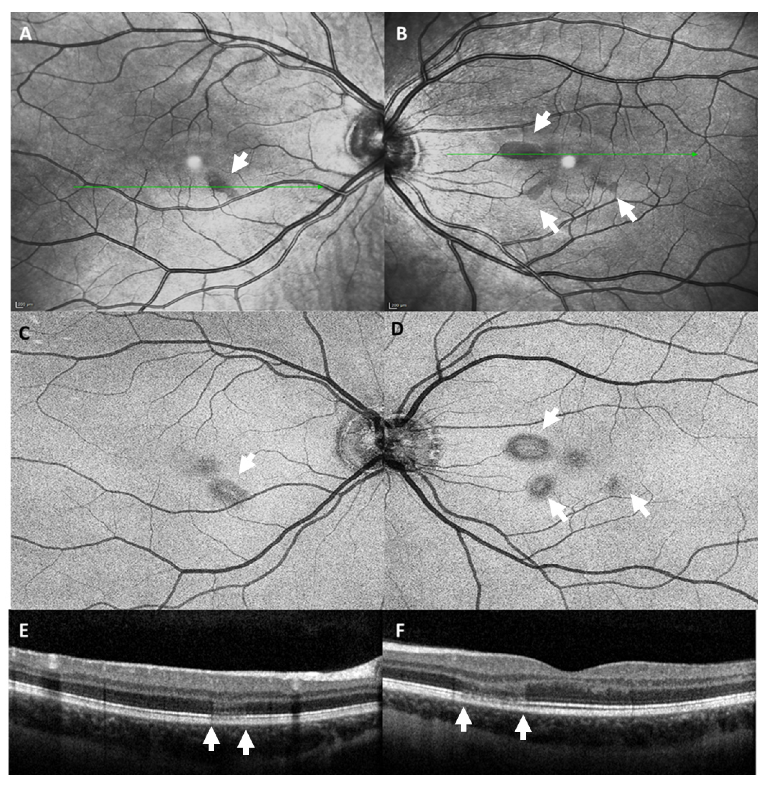Vaccines 09 01349 g006 550