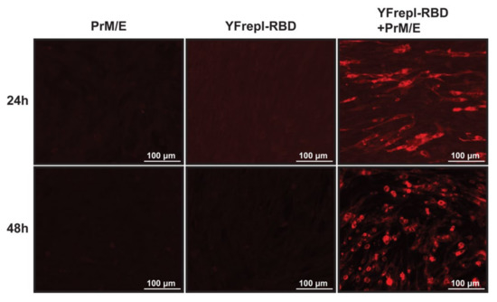 A Yellow Fever 17D Virus Replicon-Based Vaccine Platform for