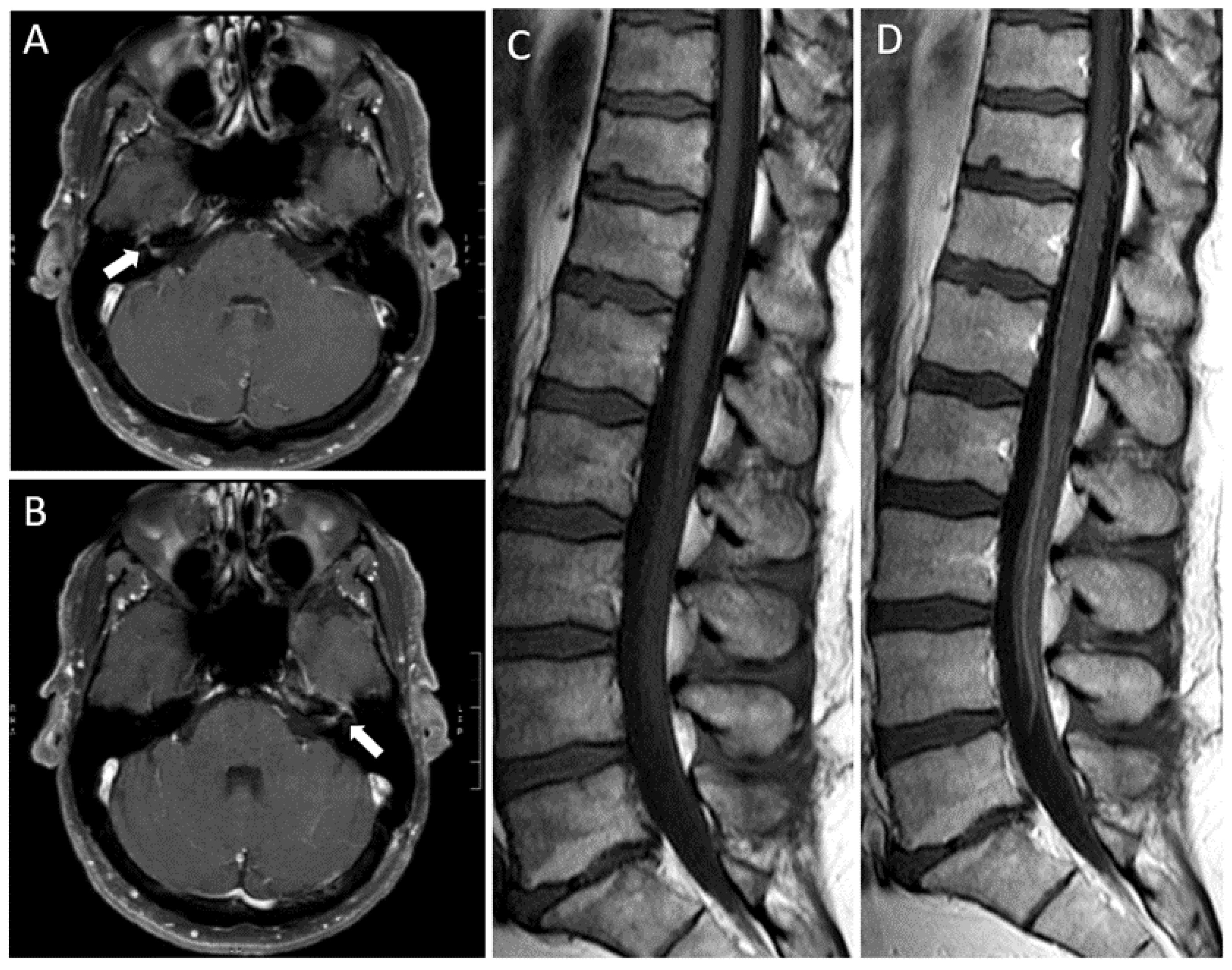 Vaccines 09 01502 g001 550