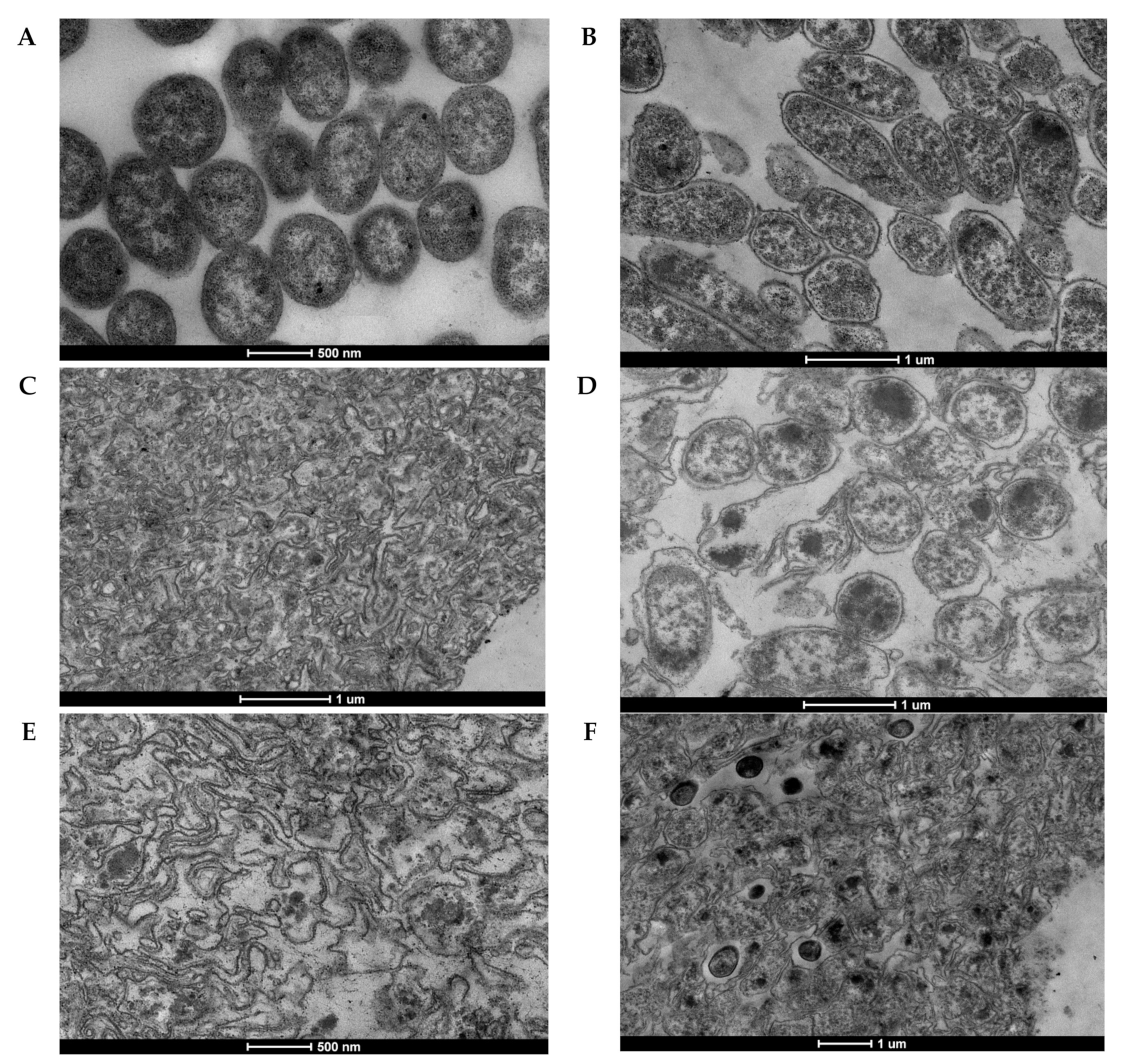 Vaccines 10 00051 g003 Vaccines 10 00051 g003