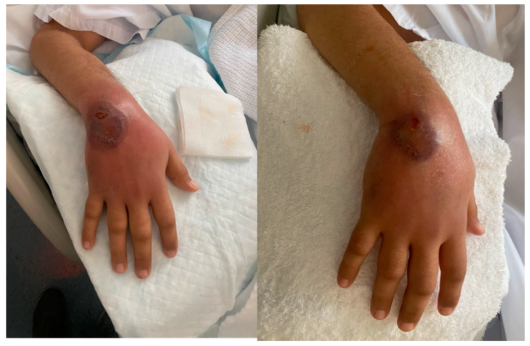 Vaccines 10 00087 g001