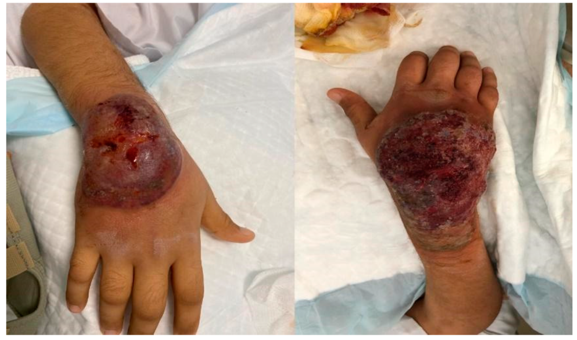 Vaccines 10 00087 g002