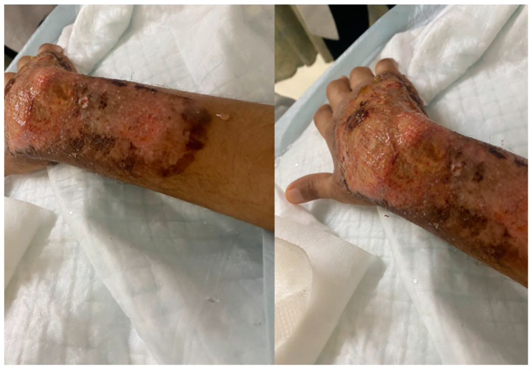 Vaccines 10 00087 g004