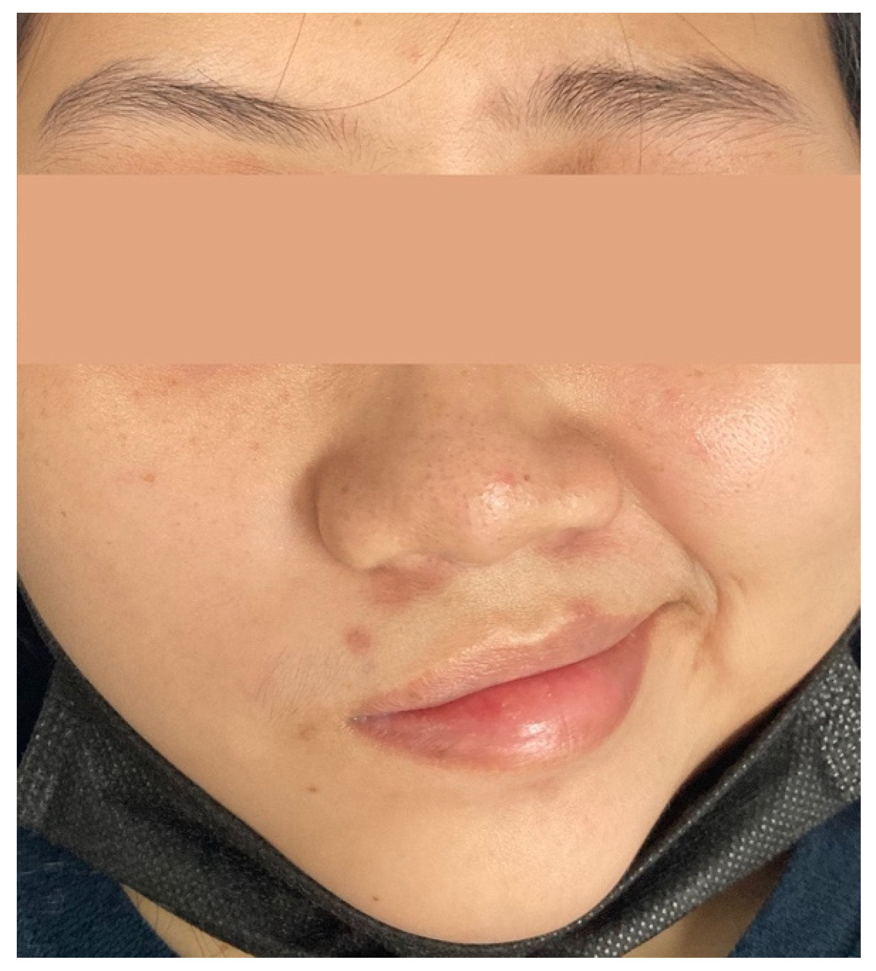 Vaccines 10 00134 g001 550