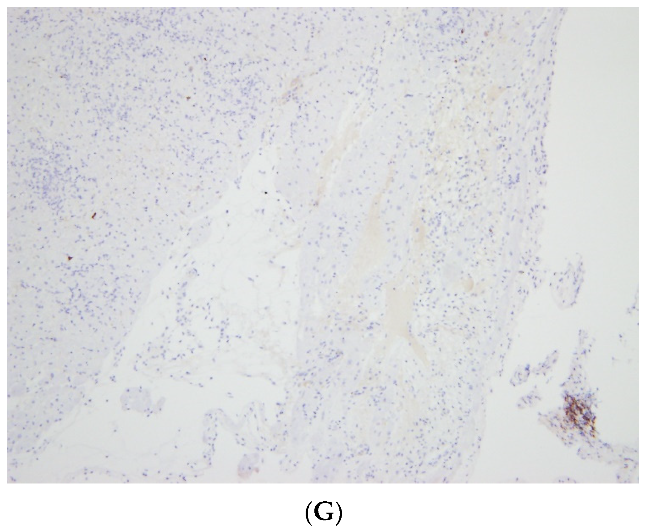Vaccines 10 00304 g002b 550
