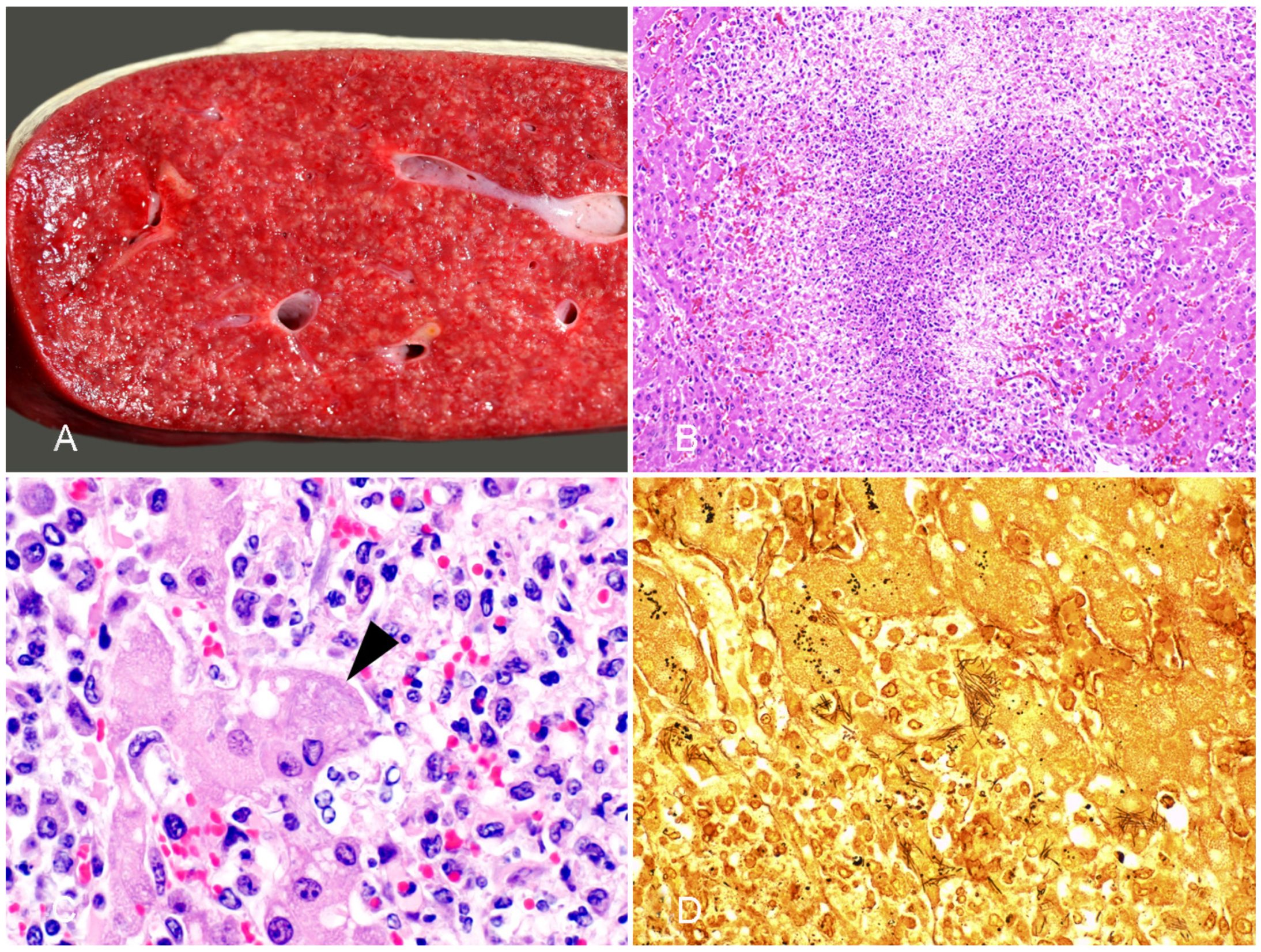 Vaccines 10 00318 g004 550