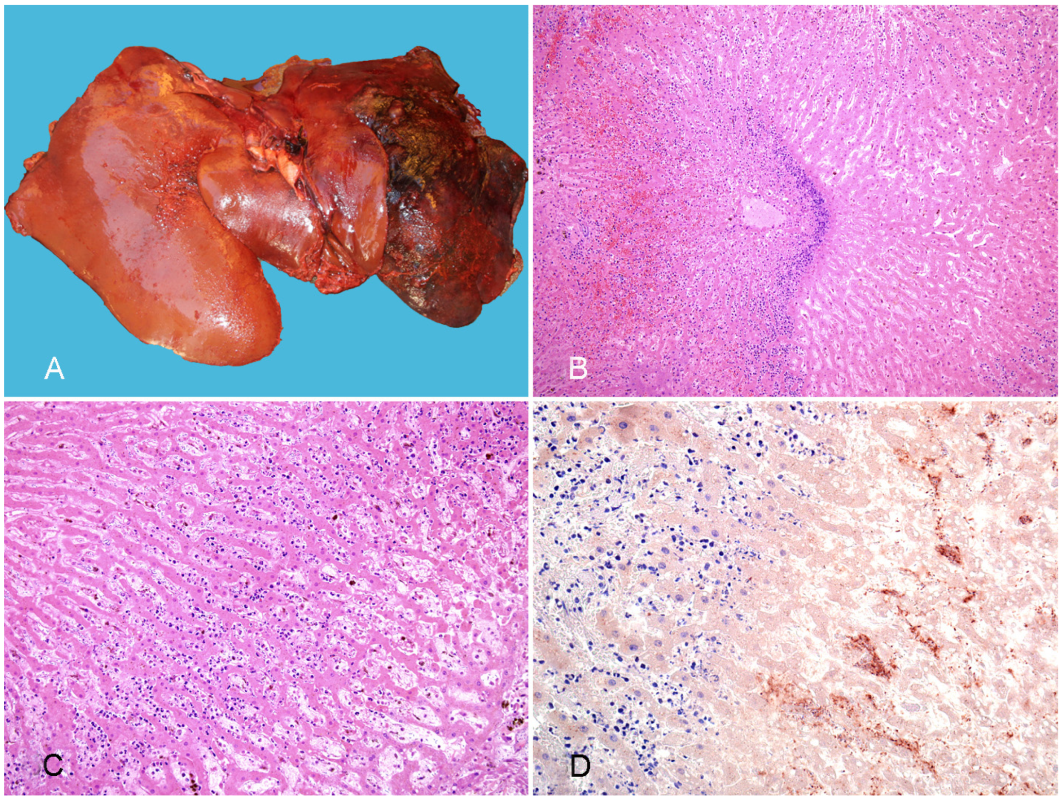 Vaccines 10 00318 g005 550