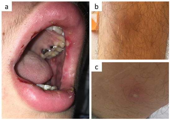 Vaccines 10 00325 g001 550