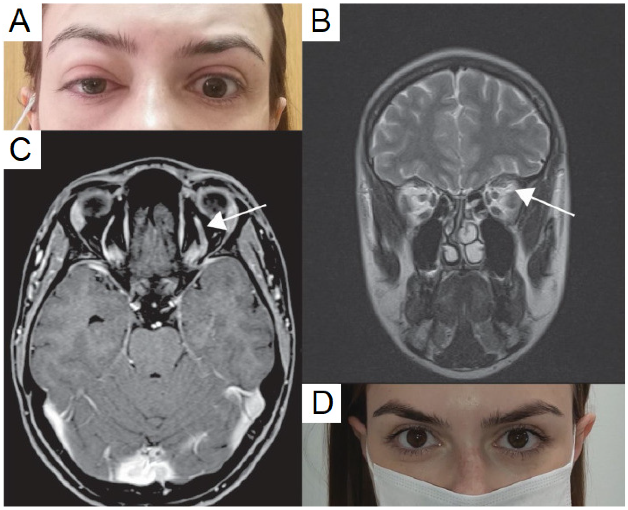 Vaccines 10 00342 g001