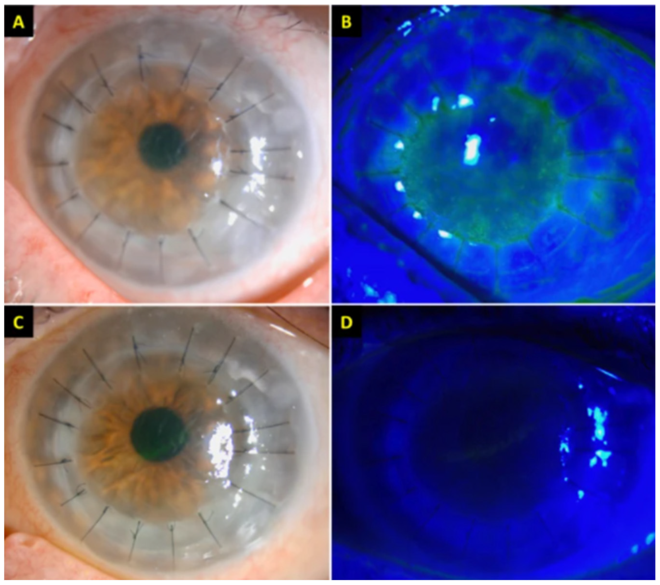 Vaccines 10 00342 g003