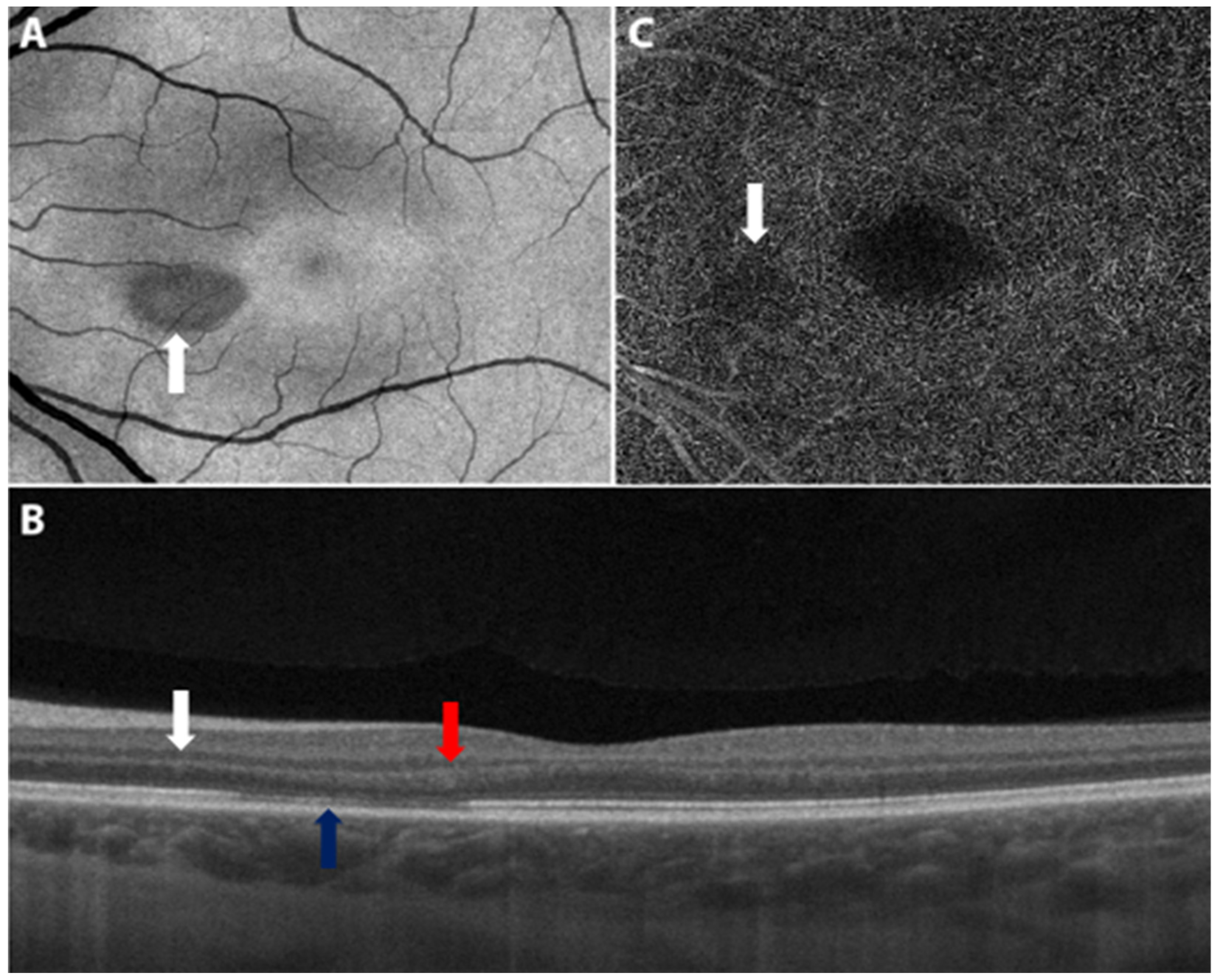 Vaccines 10 00342 g004
