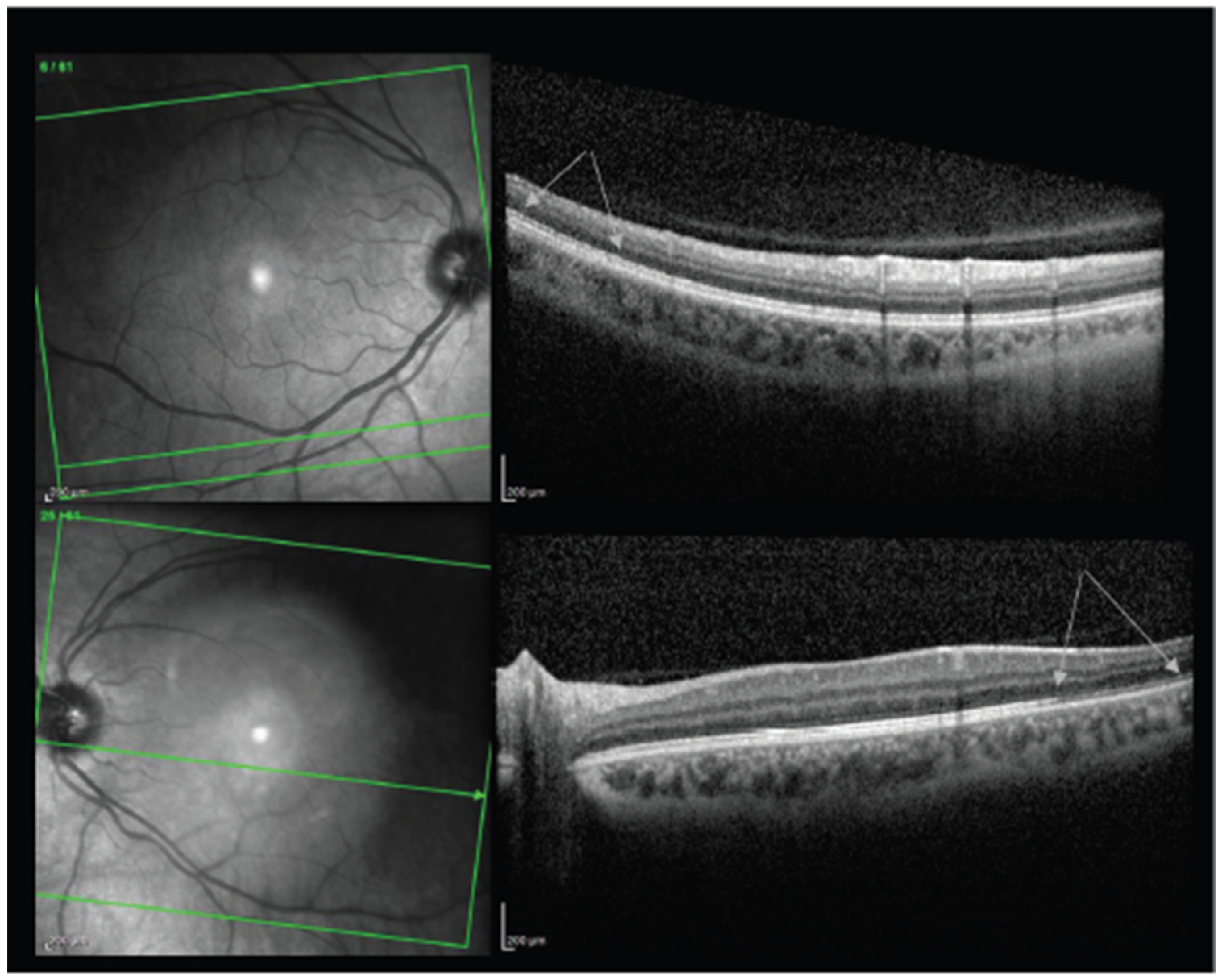Vaccines 10 00342 g005